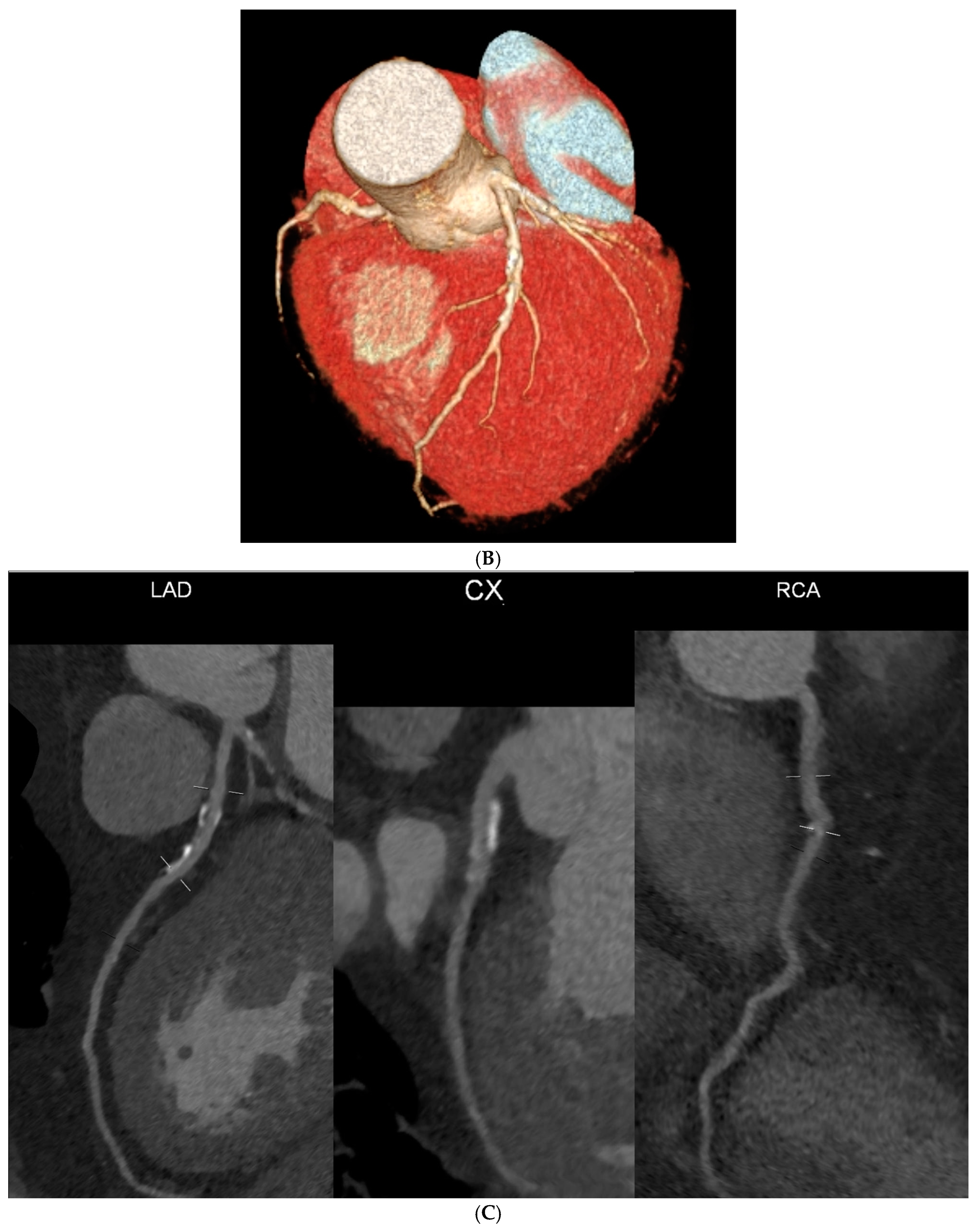Diagnostics 14 01928 g002b Diagnostics 14 01928 g002b