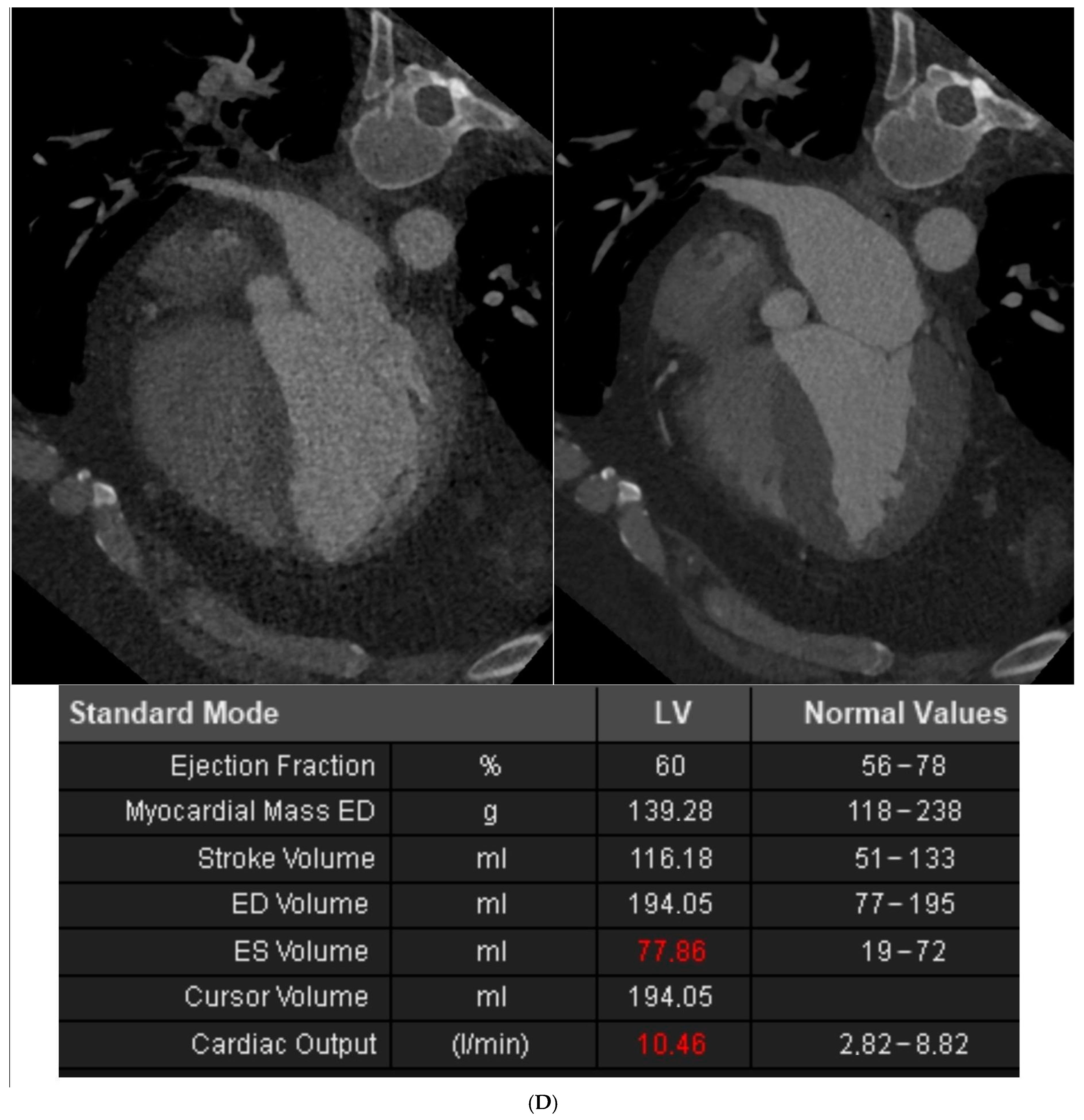 Diagnostics 14 01928 g002c Diagnostics 14 01928 g002c