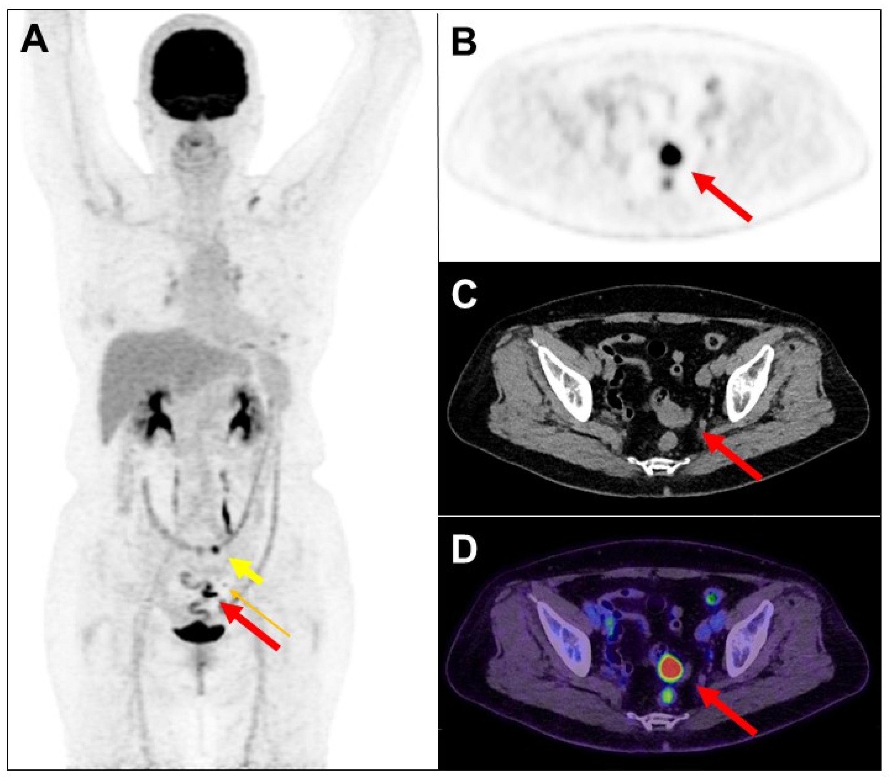 Diagnostics 14 01936 g001