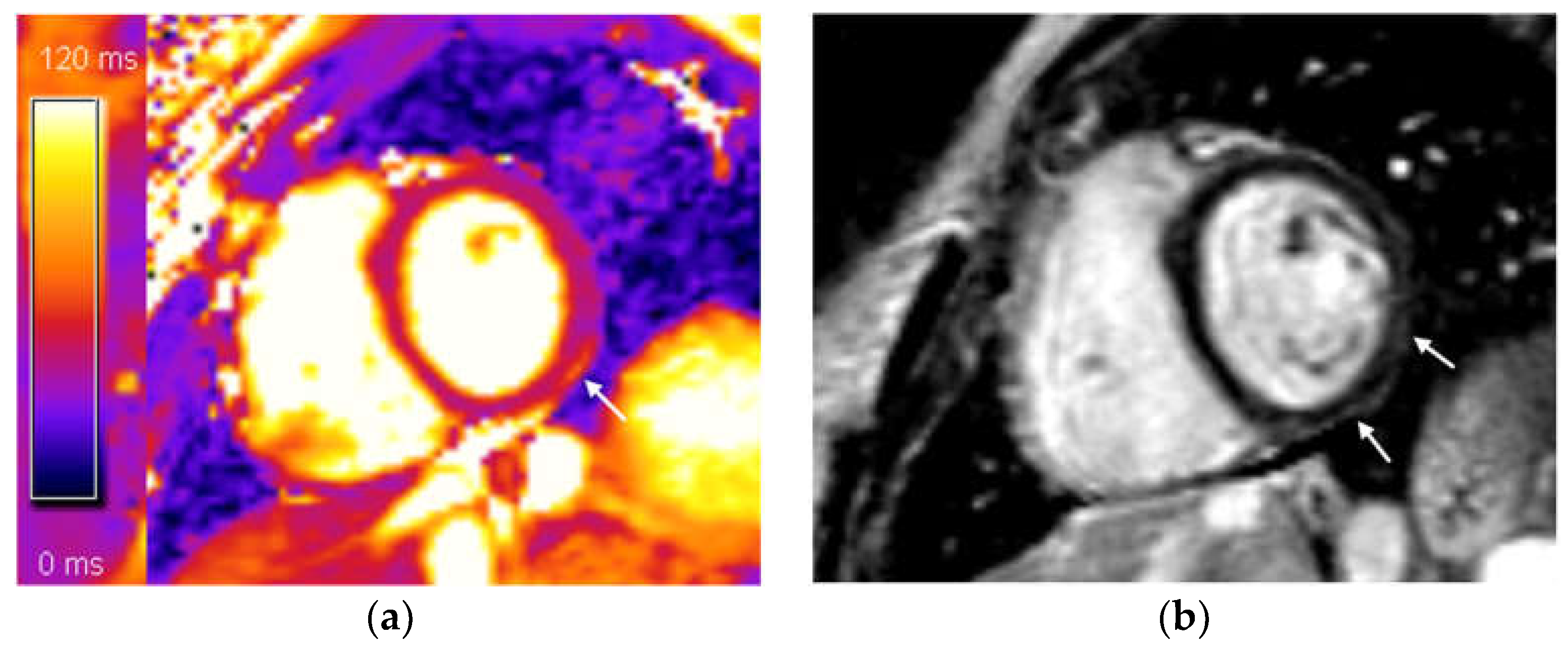 Diagnostics 14 01937 g002