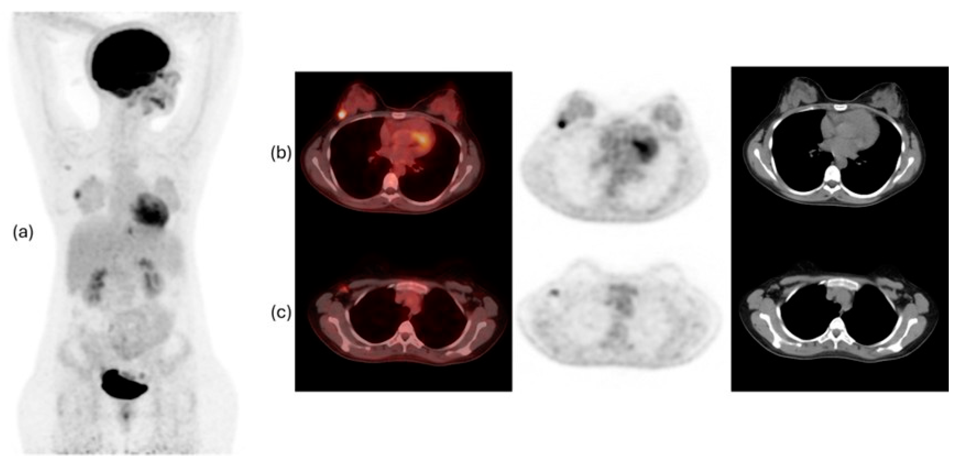 Diagnostic Breast Imaging 第2版 Diagnostic Breast Imaging: Mammography, Sonography, MRI and