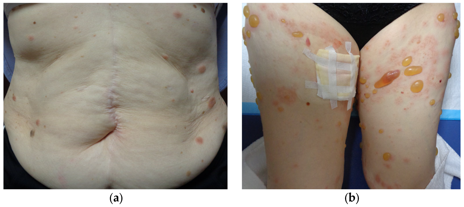 Diagnostics 14 01958 g004