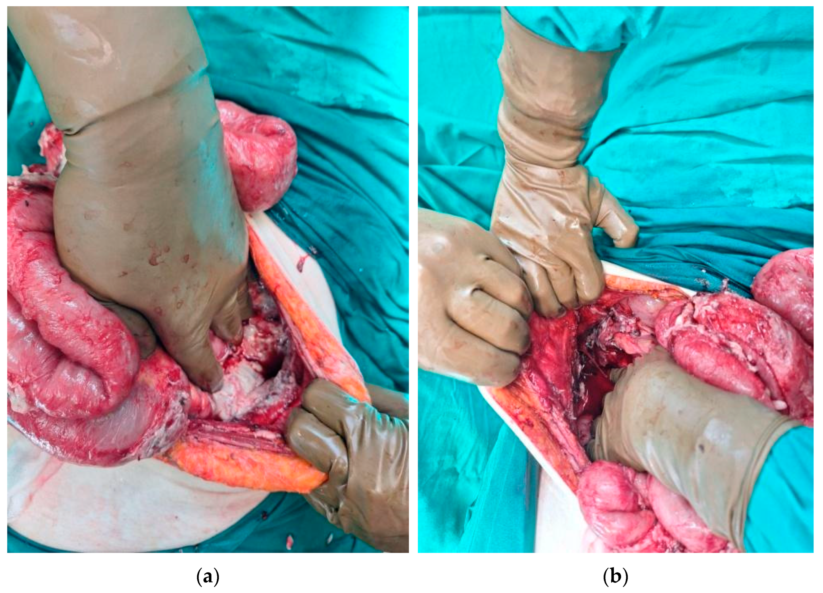 Diagnostics 14 01975 g003