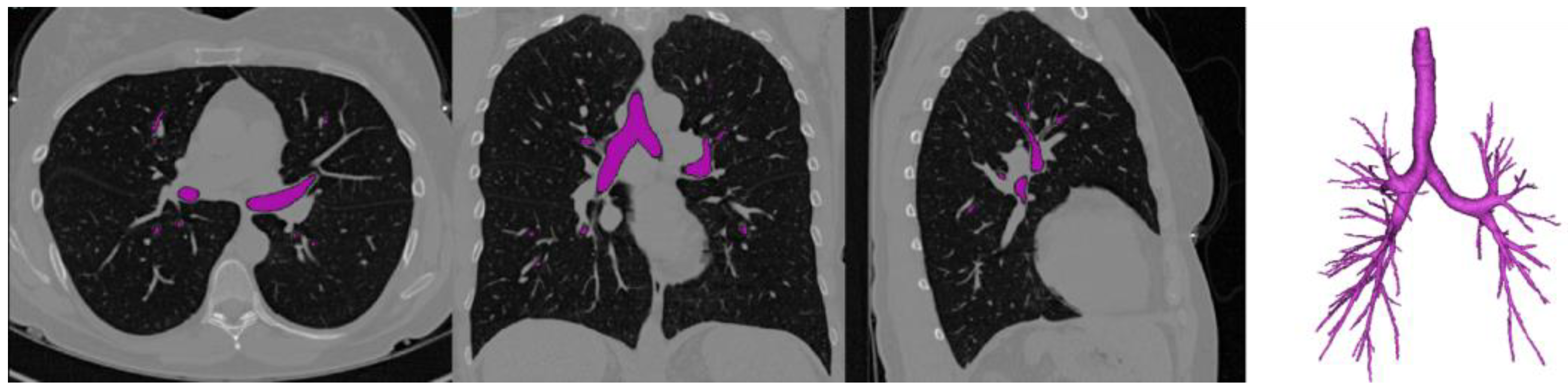 Diagnostics 14 01979 g003 Diagnostics 14 01979 g003