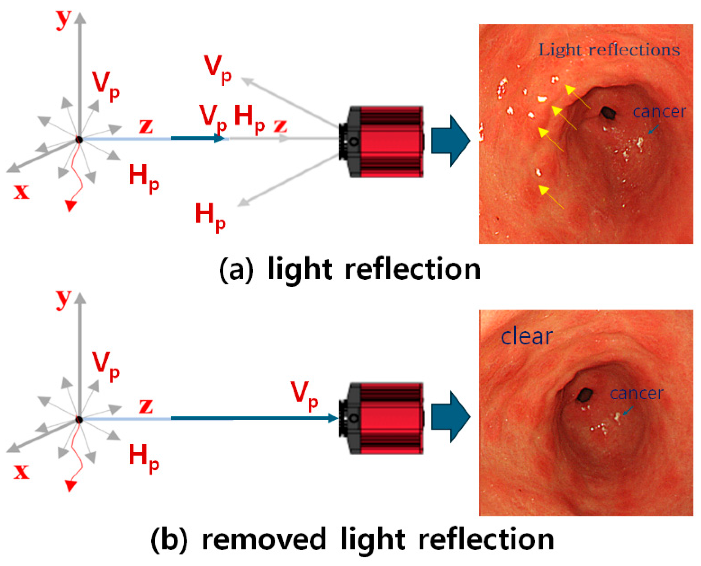 Diagnostics 14 01996 g006 Diagnostics 14 01996 g006