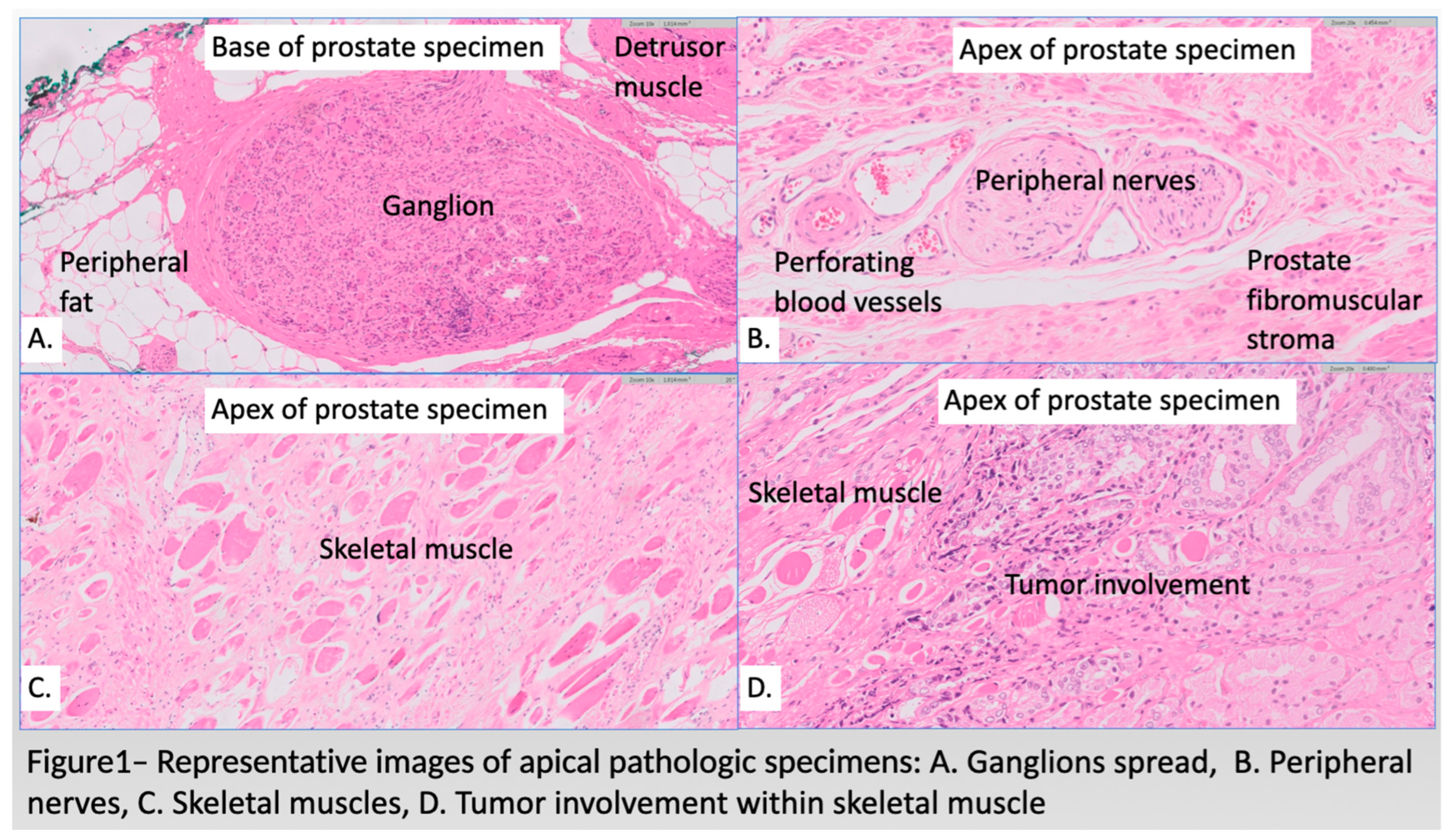 Diagnostics 14 02001 g001 Diagnostics 14 02001 g001
