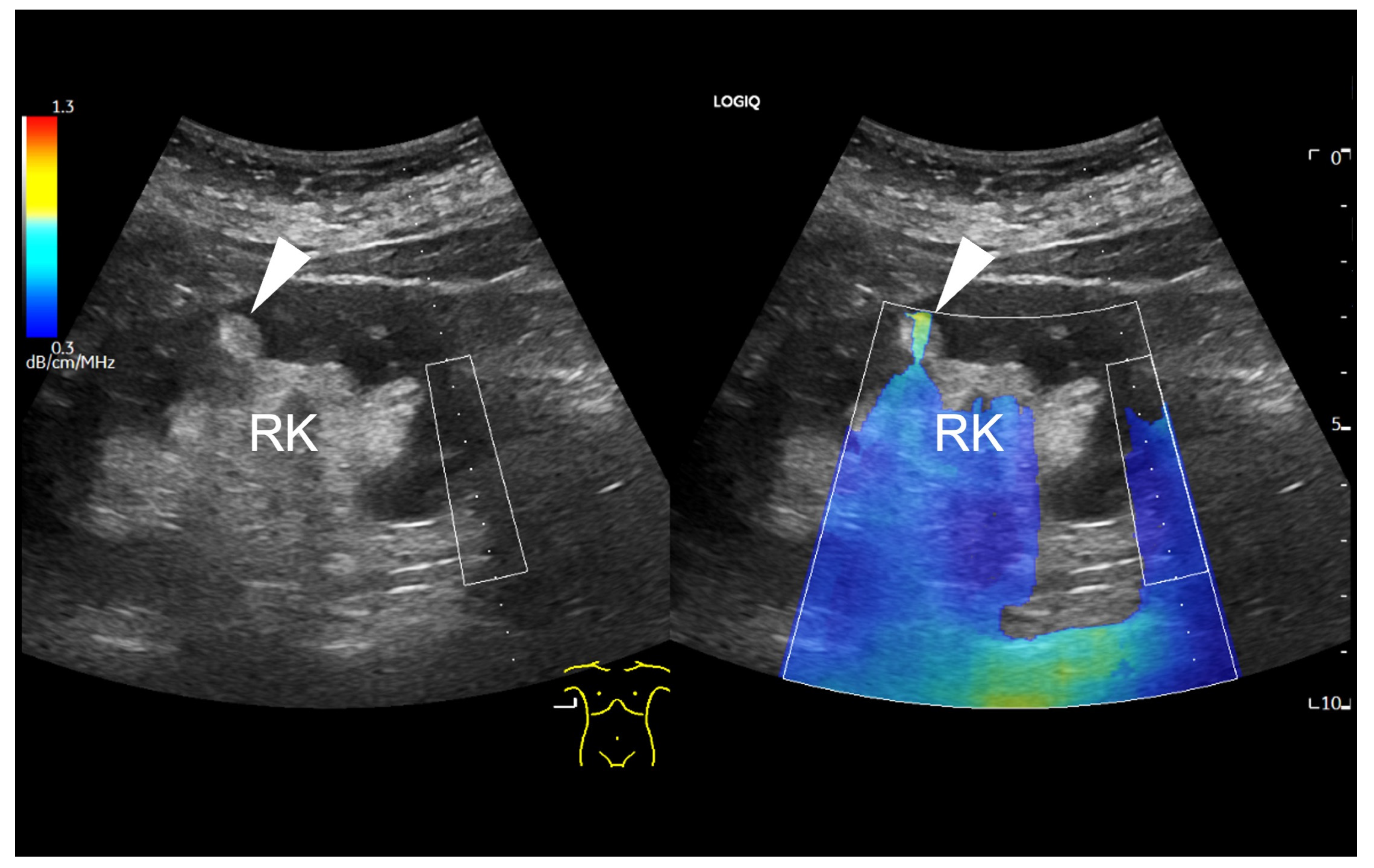 Diagnostics 14 02002 g002