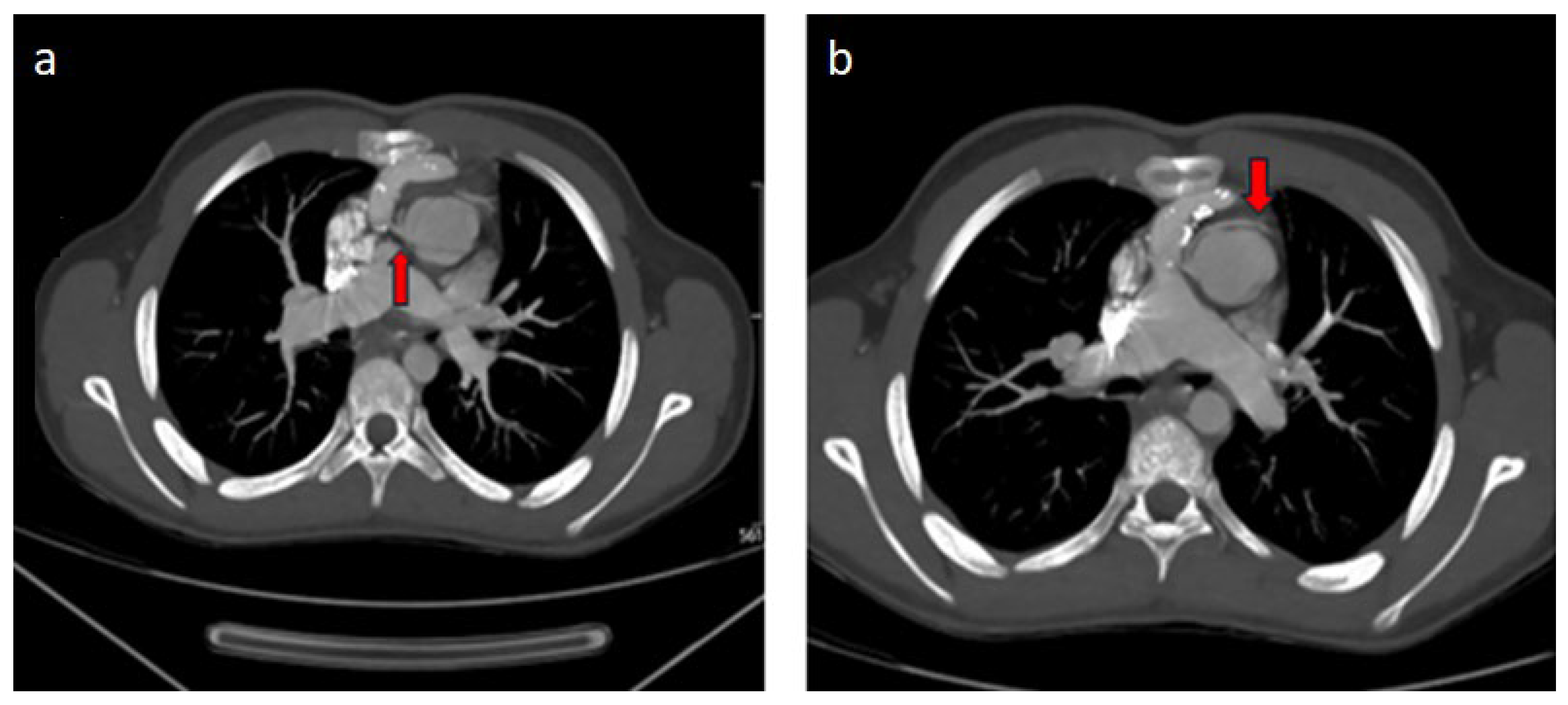 Diagnostics 14 02022 g003
