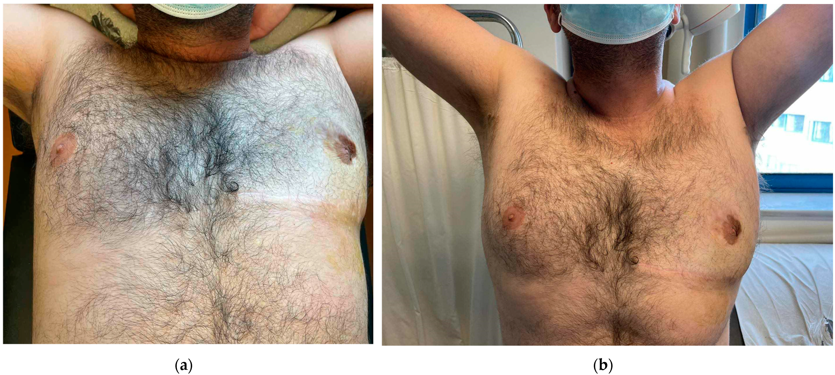 Diagnostics 14 02058 g005