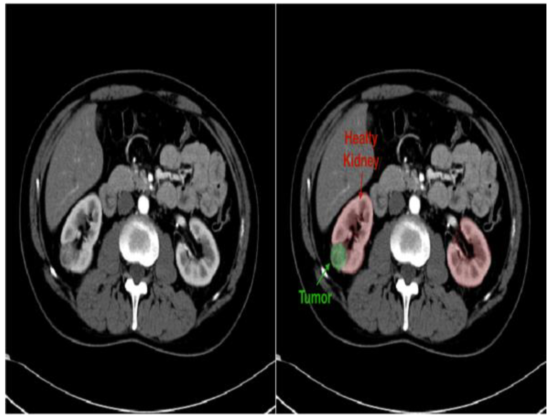 Diagnostics 14 02059 g007 Diagnostics 14 02059 g007