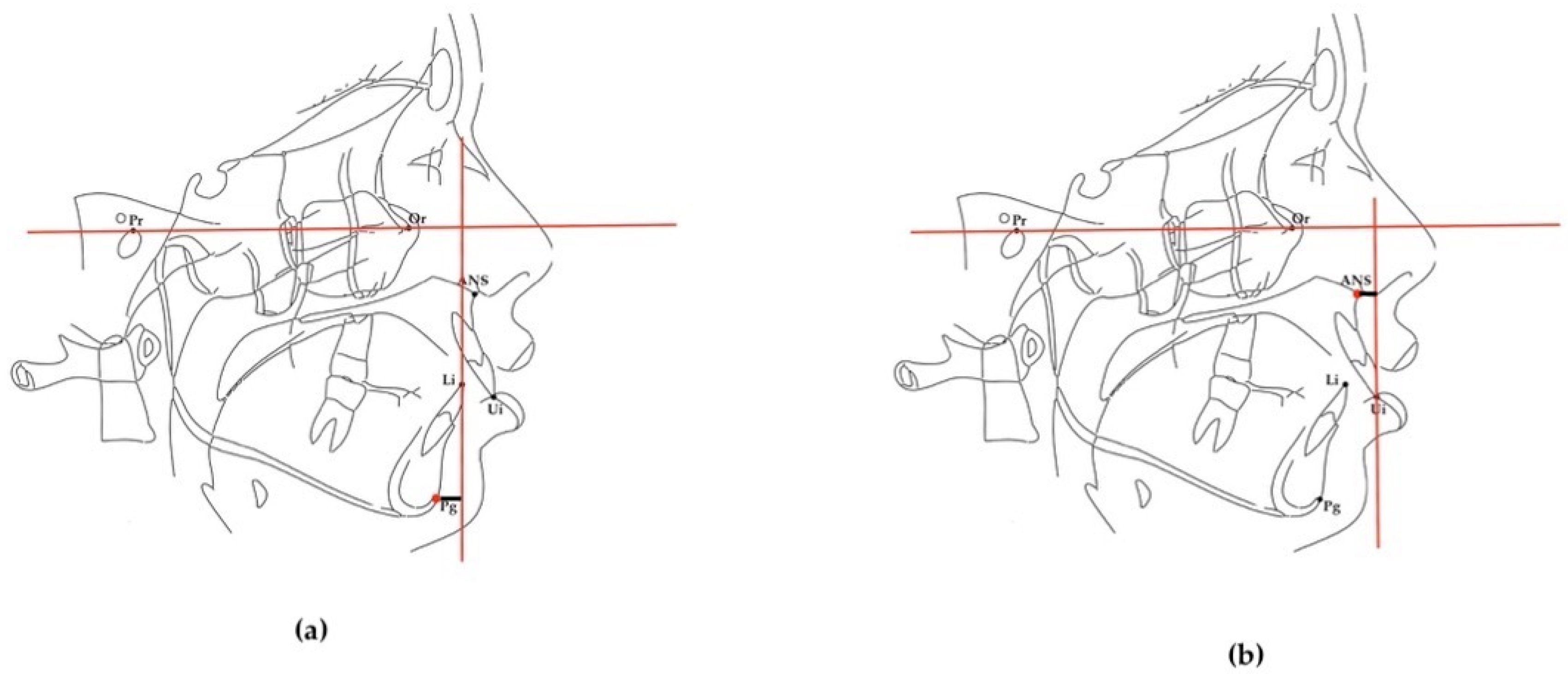 Diagnostics 14 02062 g002