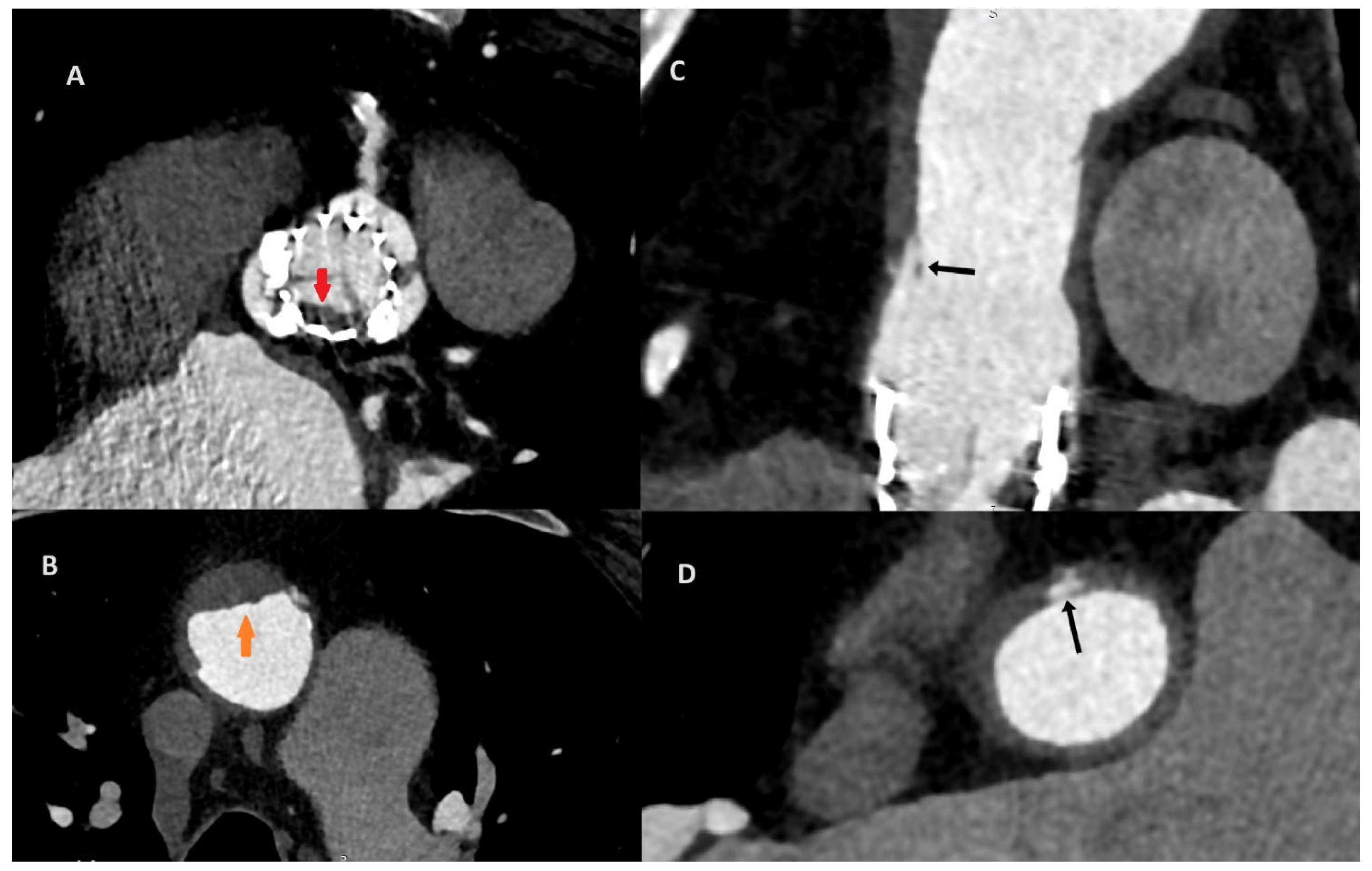 Diagnostics 14 02070 g002
