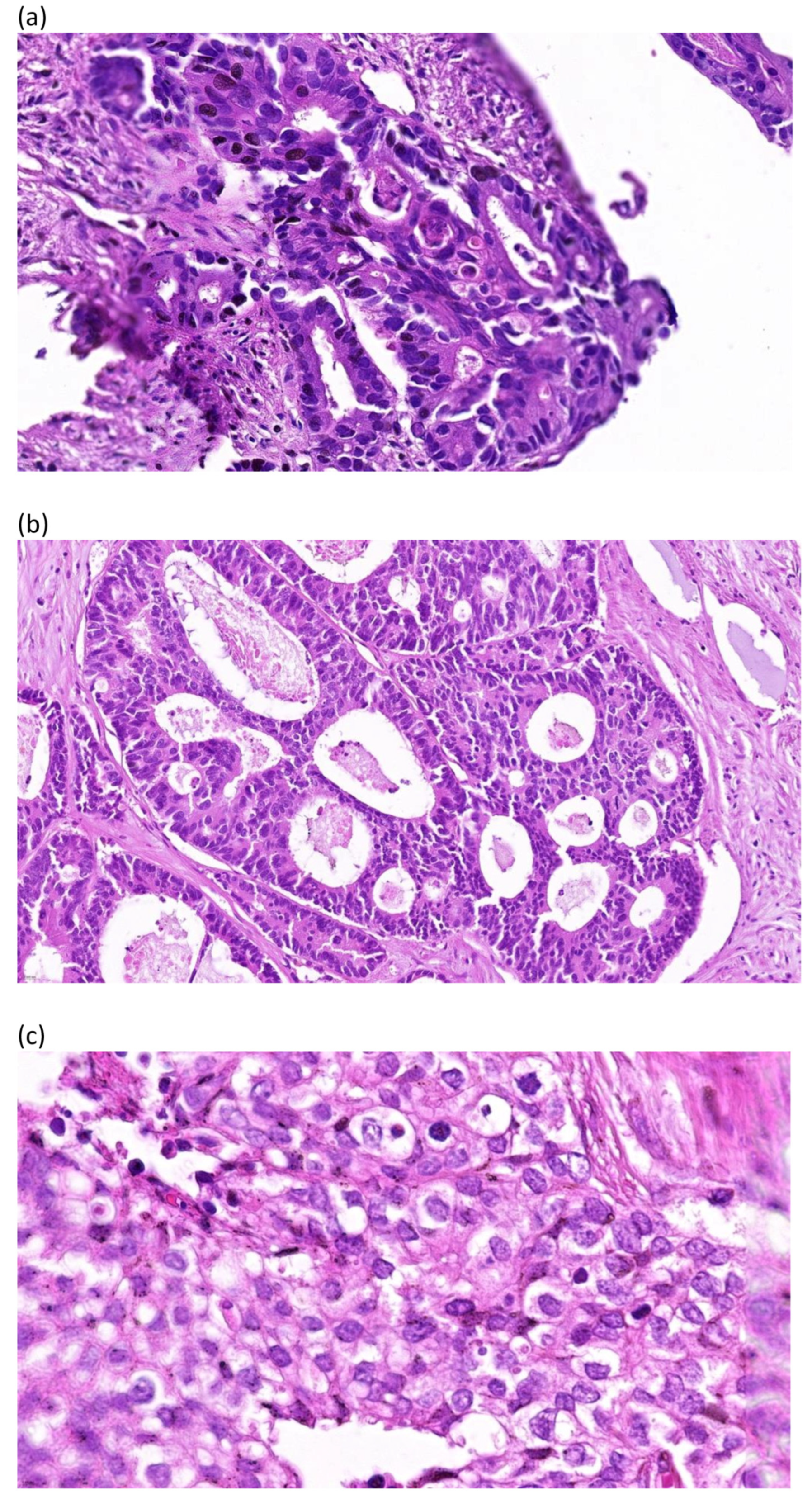 Diagnostics 14 02073 g001 Diagnostics 14 02073 g001