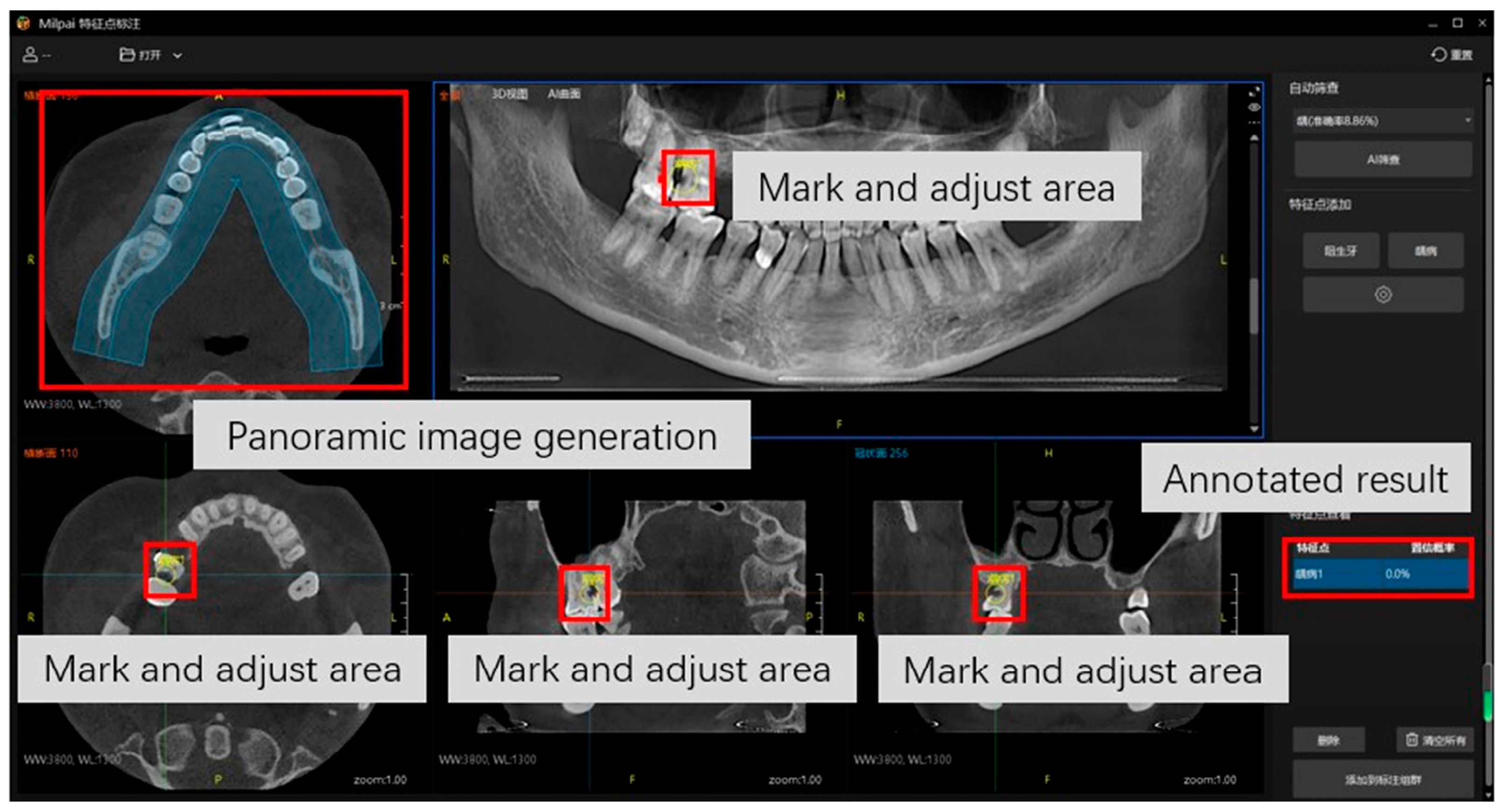 Diagnostics 14 02080 g004