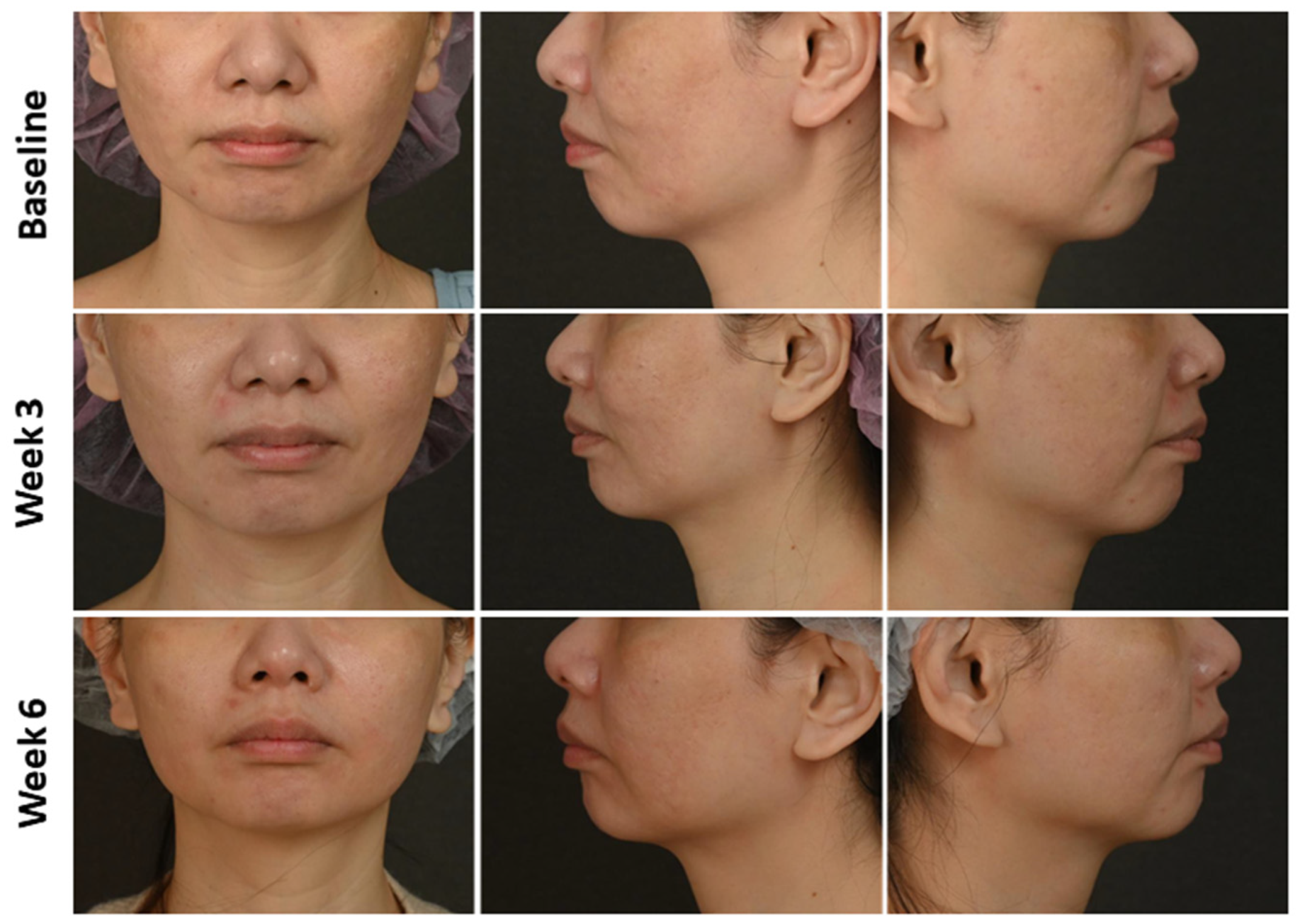 Diagnostics 14 02083 g004