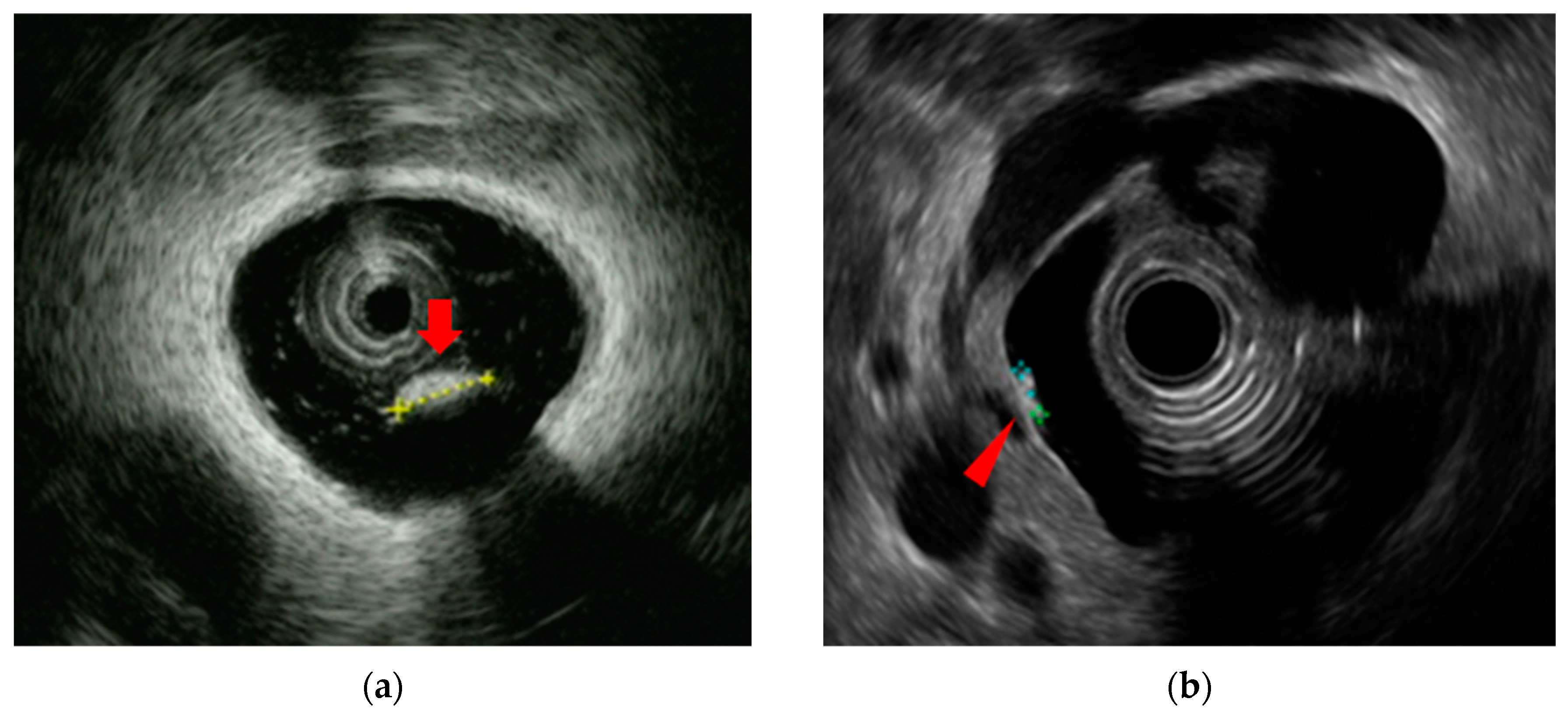 Diagnostics 14 02086 g003 Diagnostics 14 02086 g003