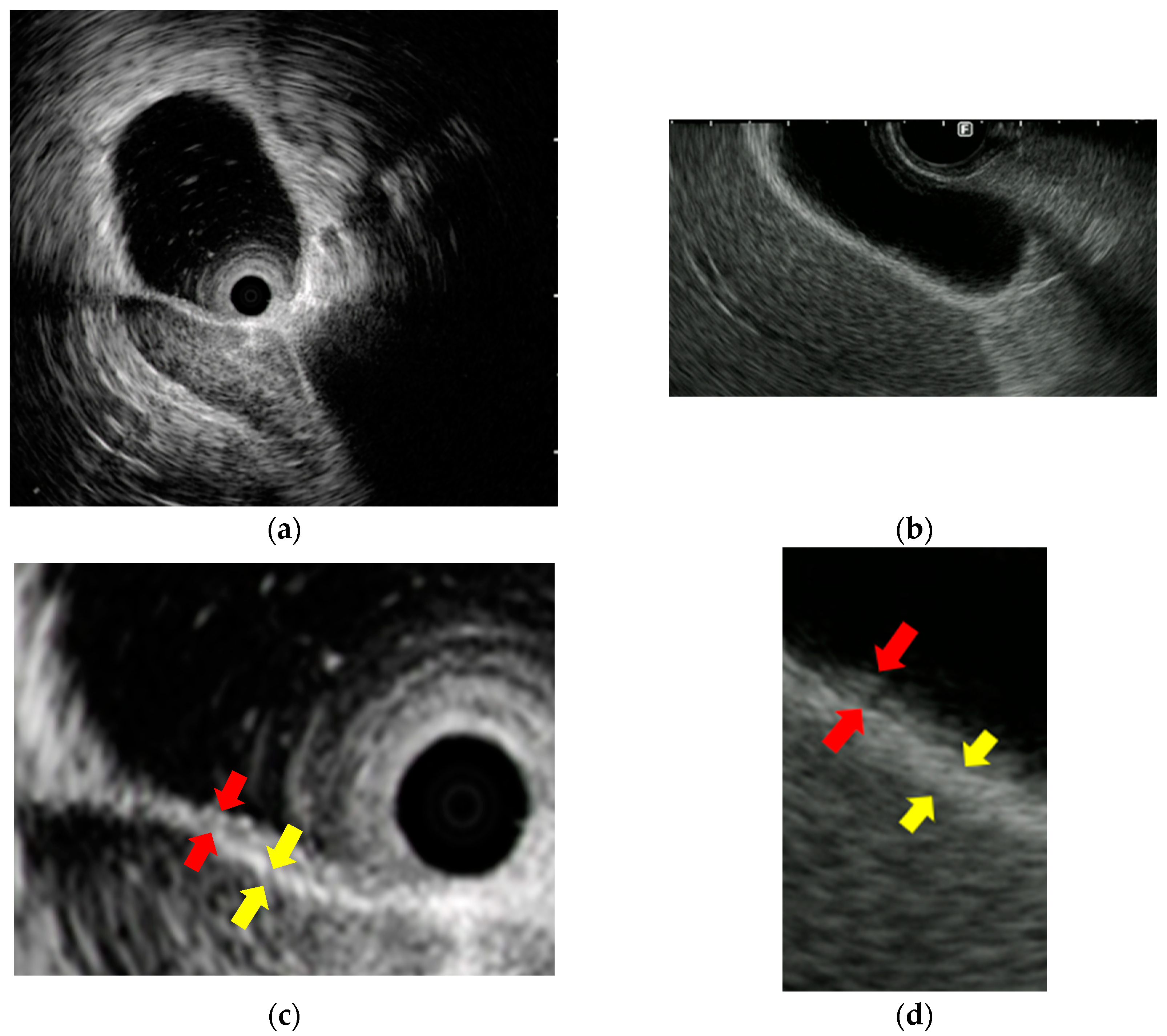 Diagnostics 14 02086 g004 Diagnostics 14 02086 g004