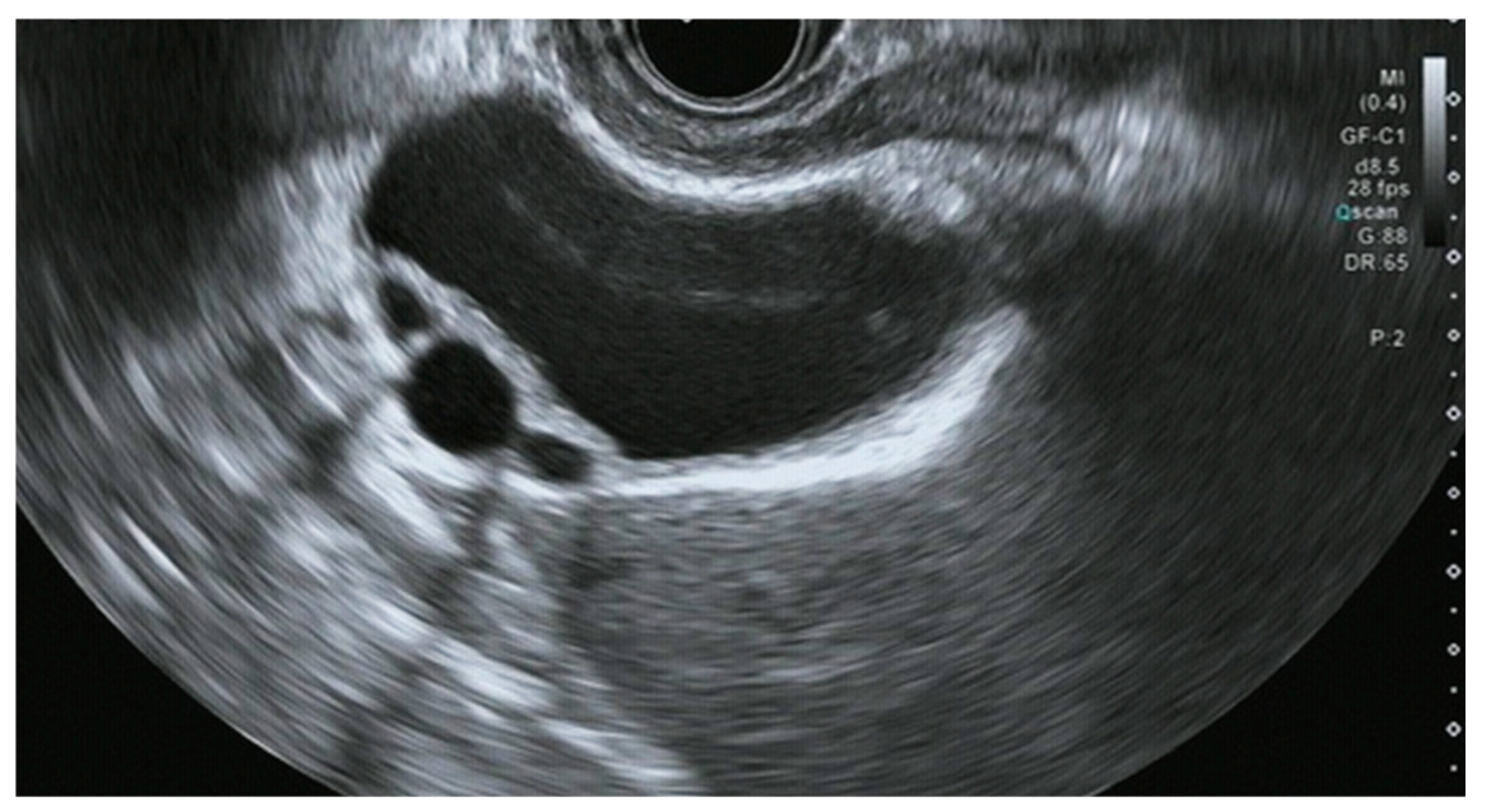 Diagnostics 14 02086 g005 Diagnostics 14 02086 g005