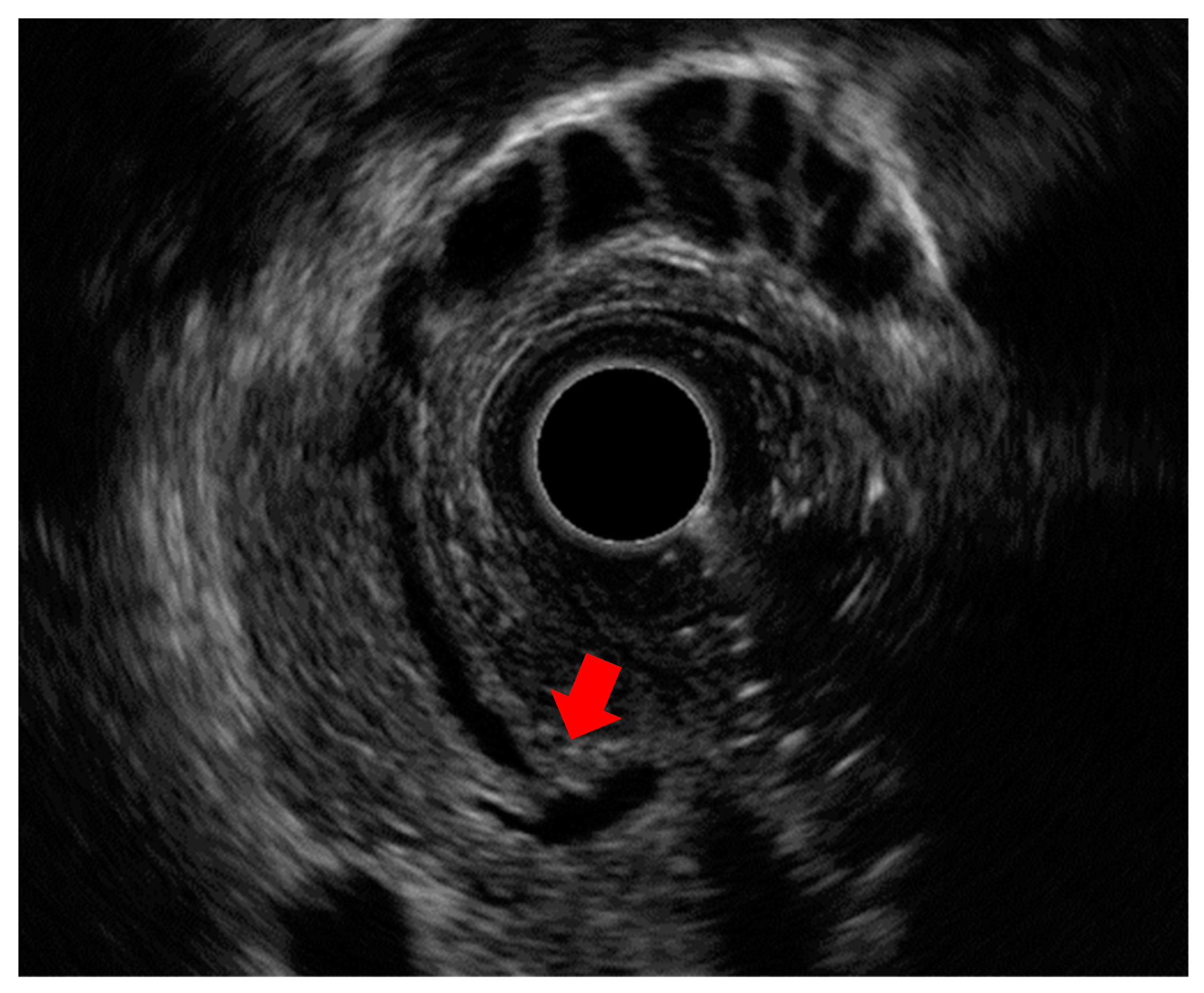 Diagnostics 14 02086 g006 Diagnostics 14 02086 g006