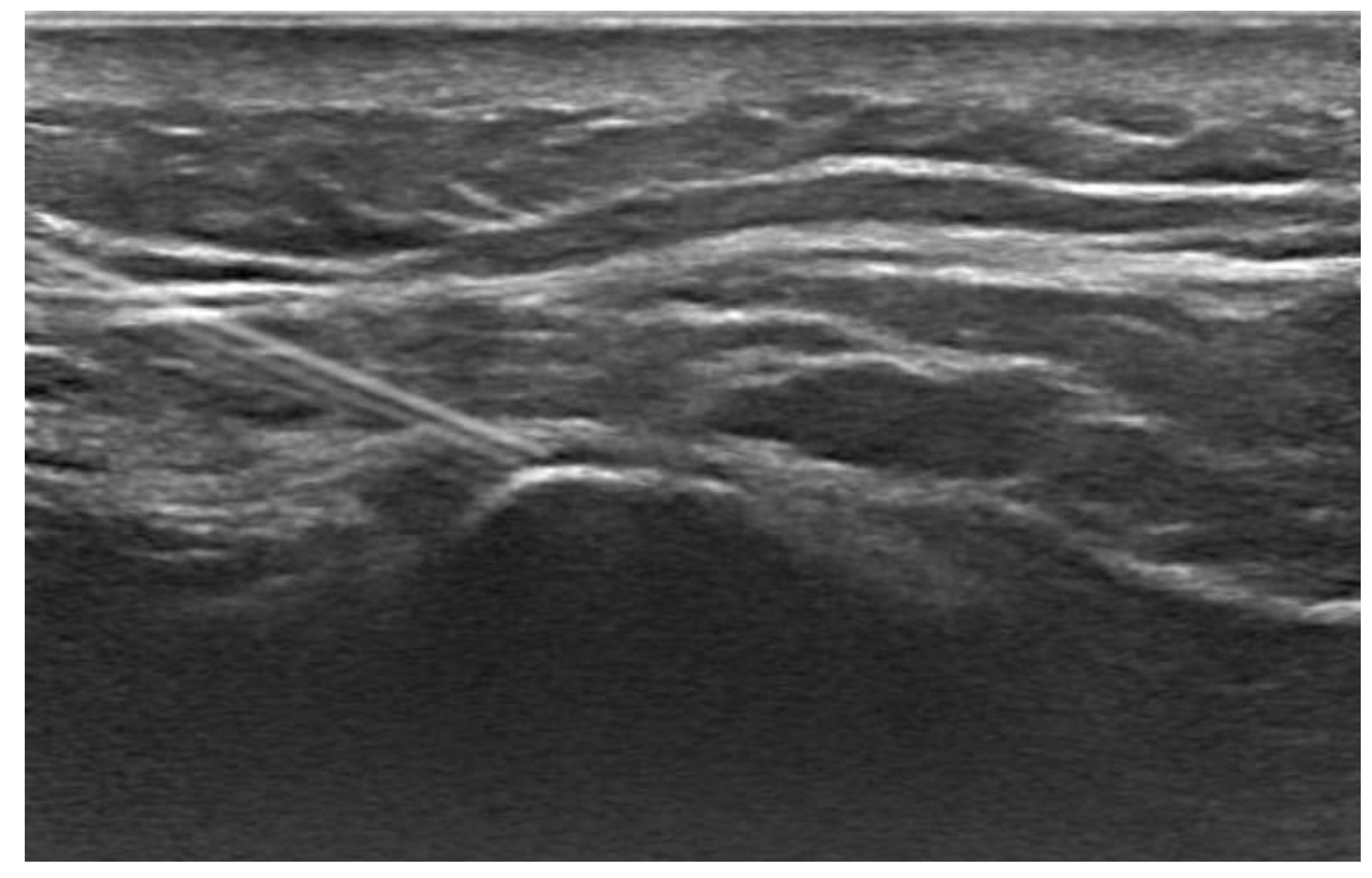 Diagnostics 14 02087 g001