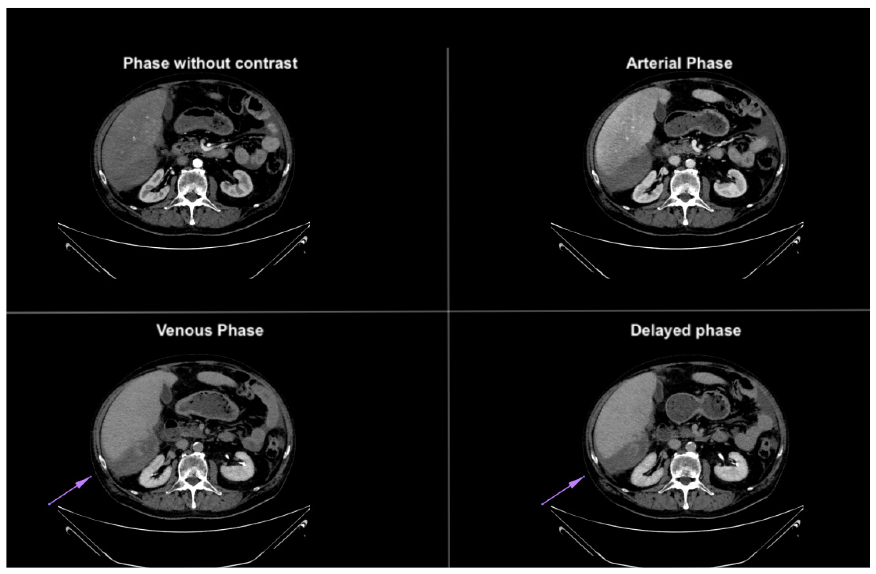 Diagnostics 14 02088 g004