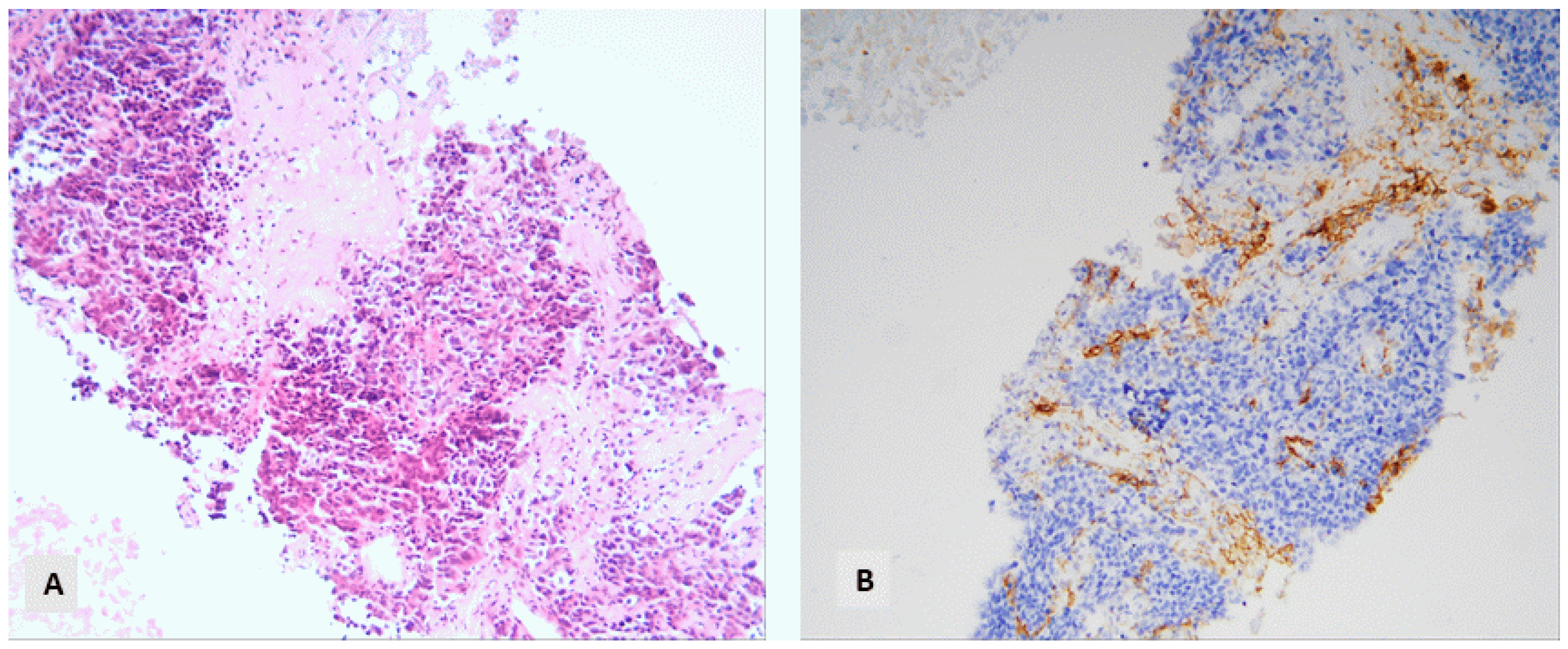 Diagnostics 14 02090 g008