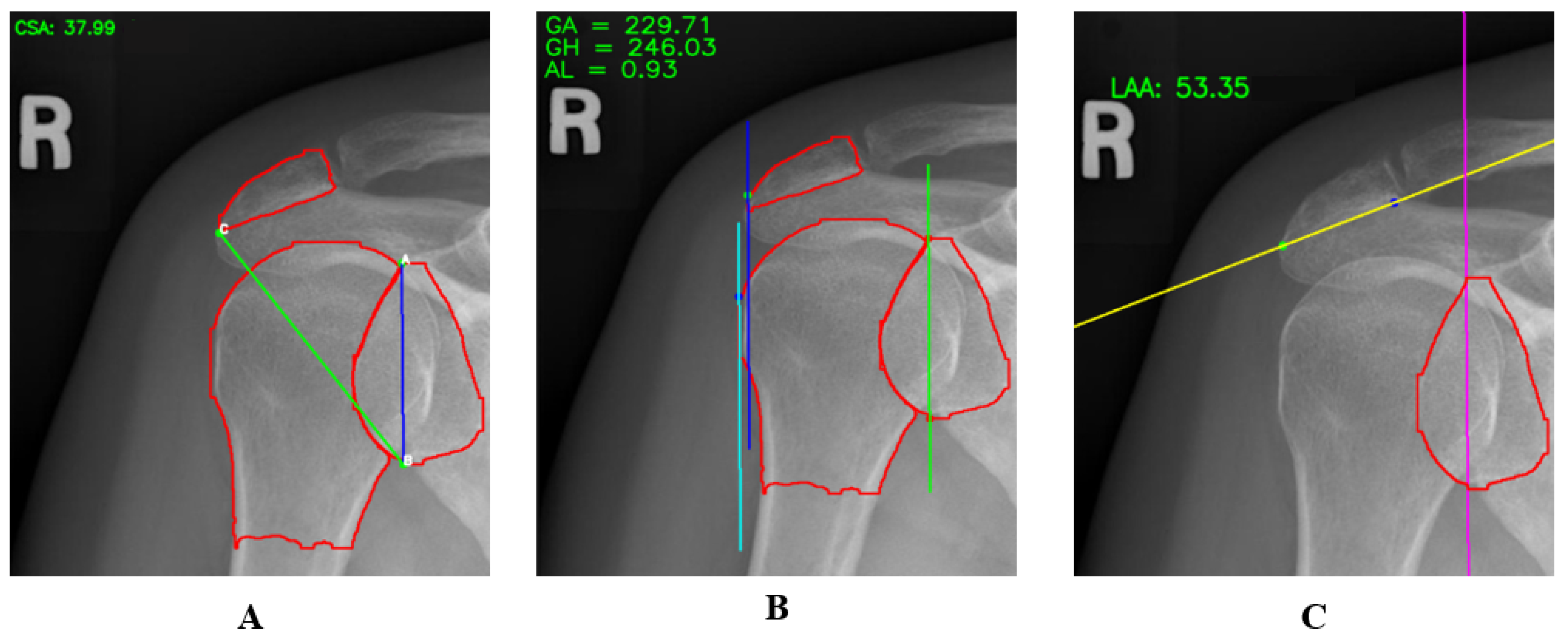 Diagnostics 14 02092 g004