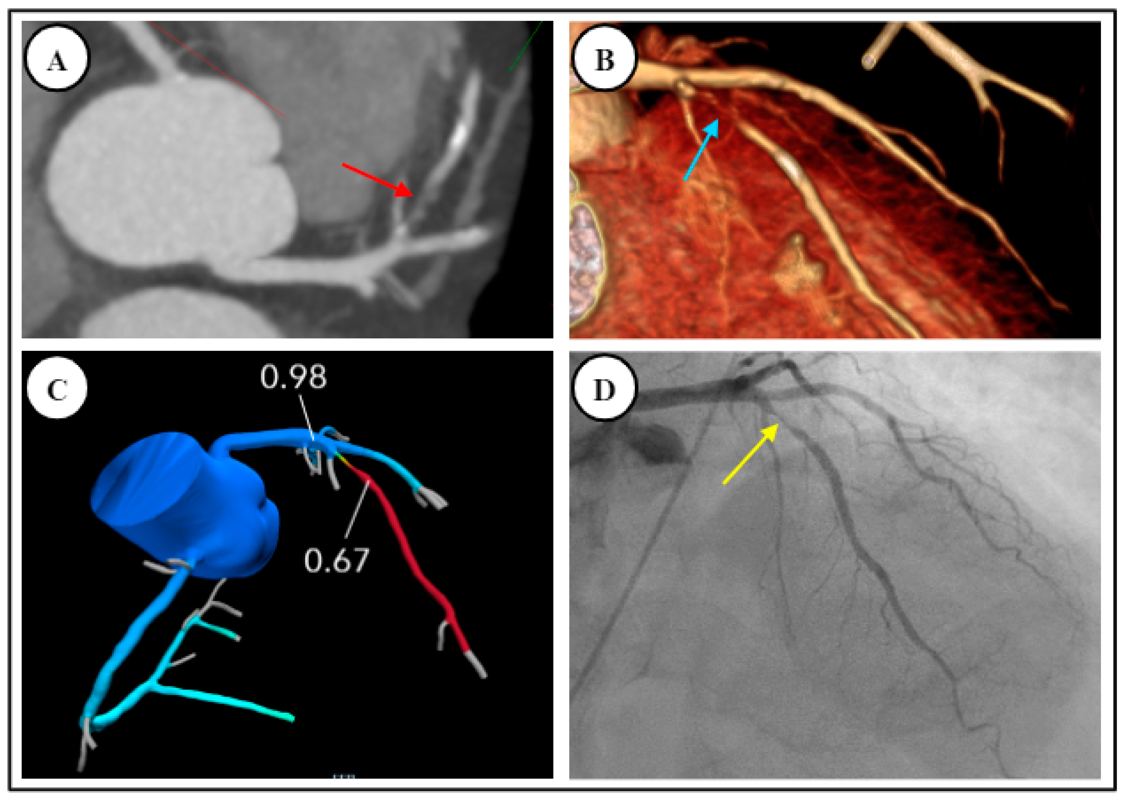 Diagnostics 14 02096 g005 Diagnostics 14 02096 g005
