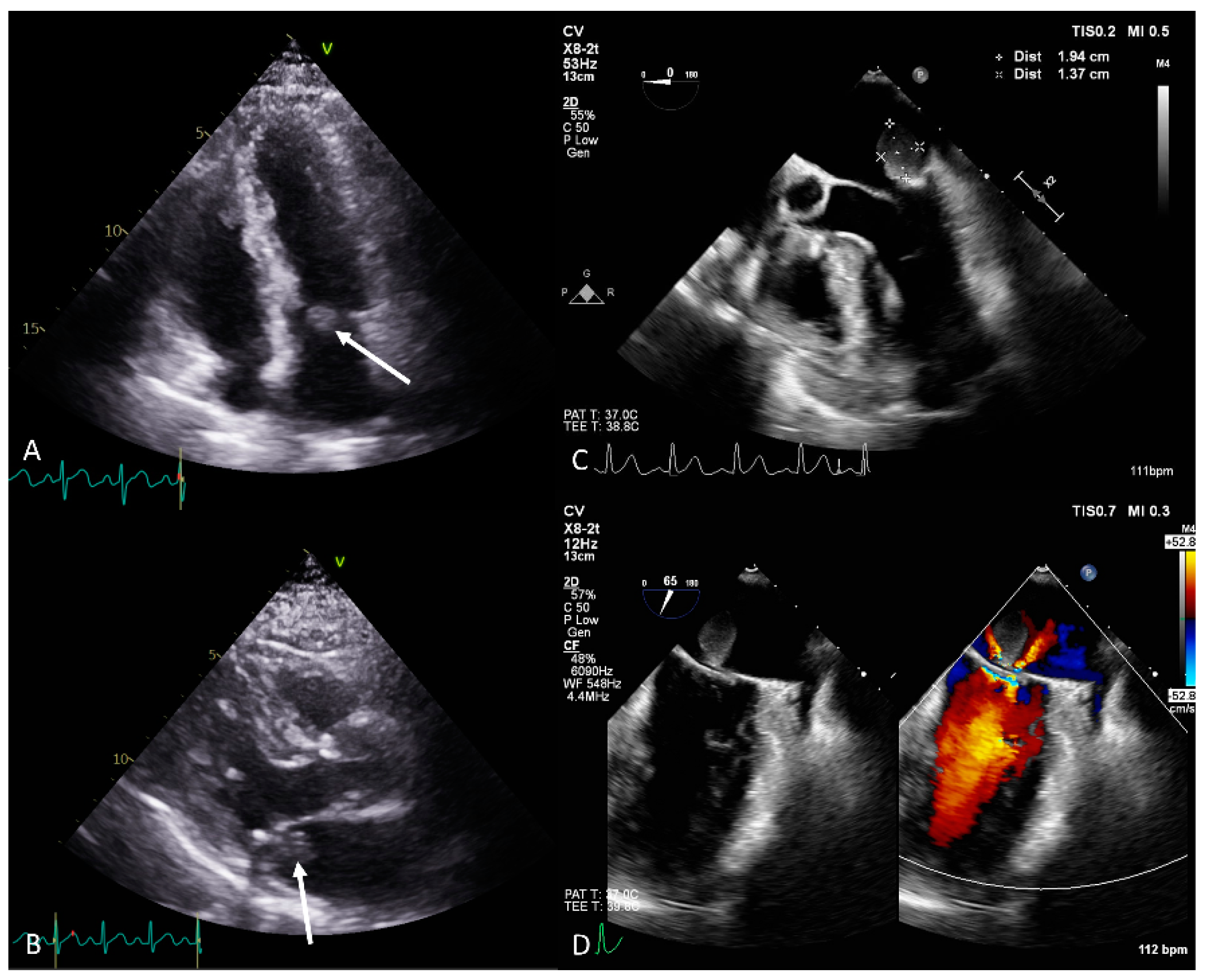 Diagnostics 14 02109 g001