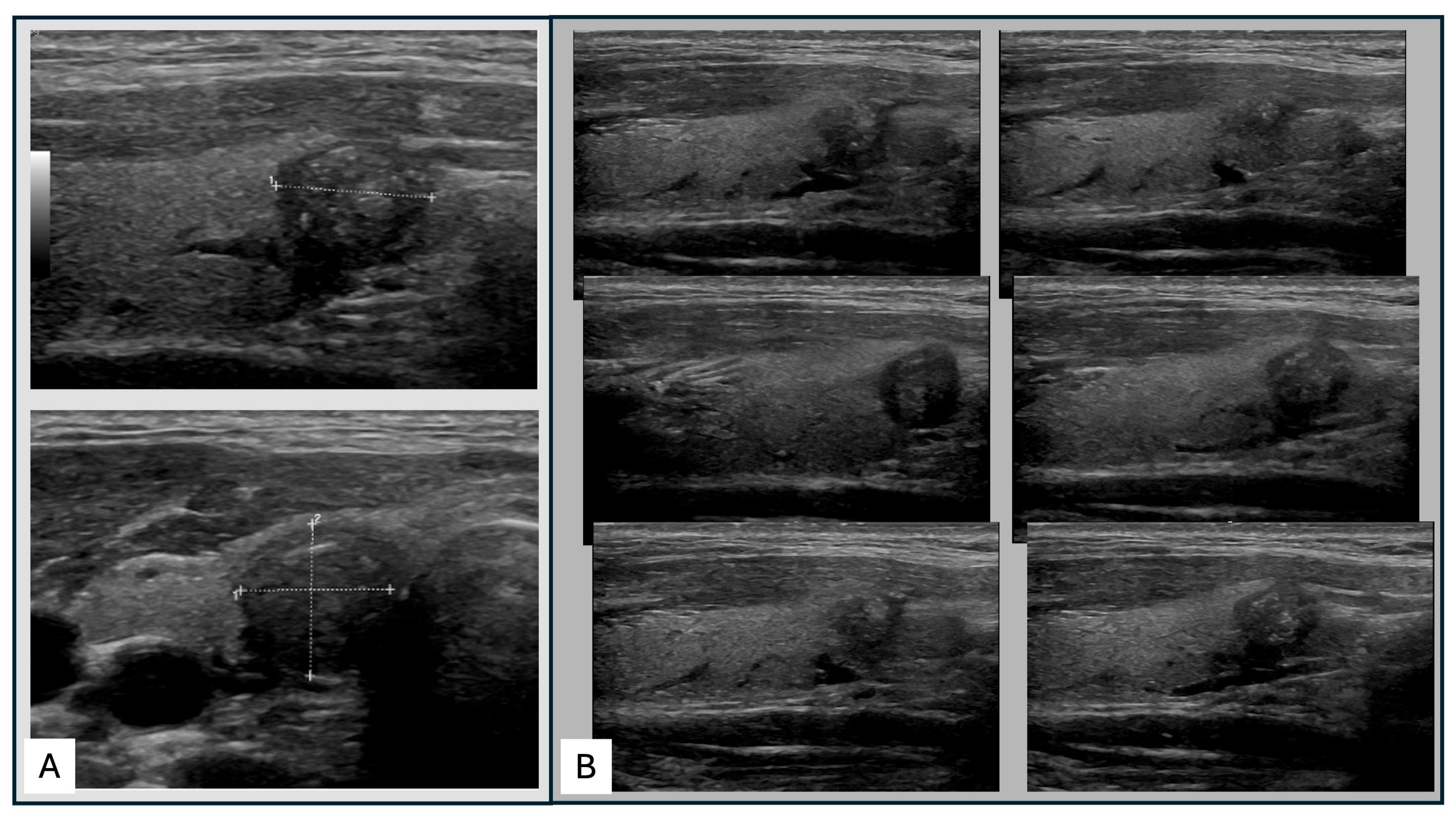 Diagnostics 14 02138 g001