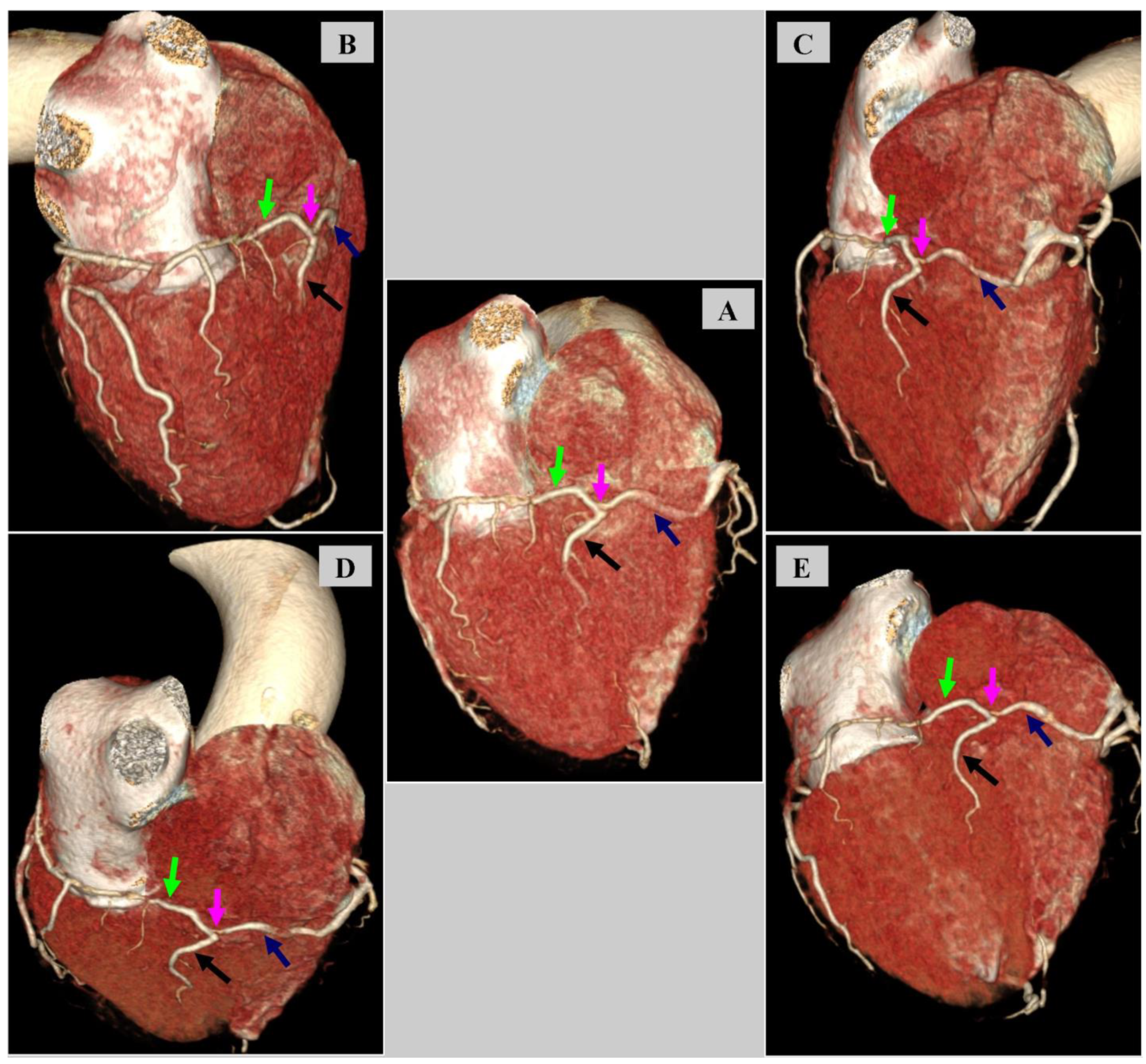Diagnostics 14 02142 g005