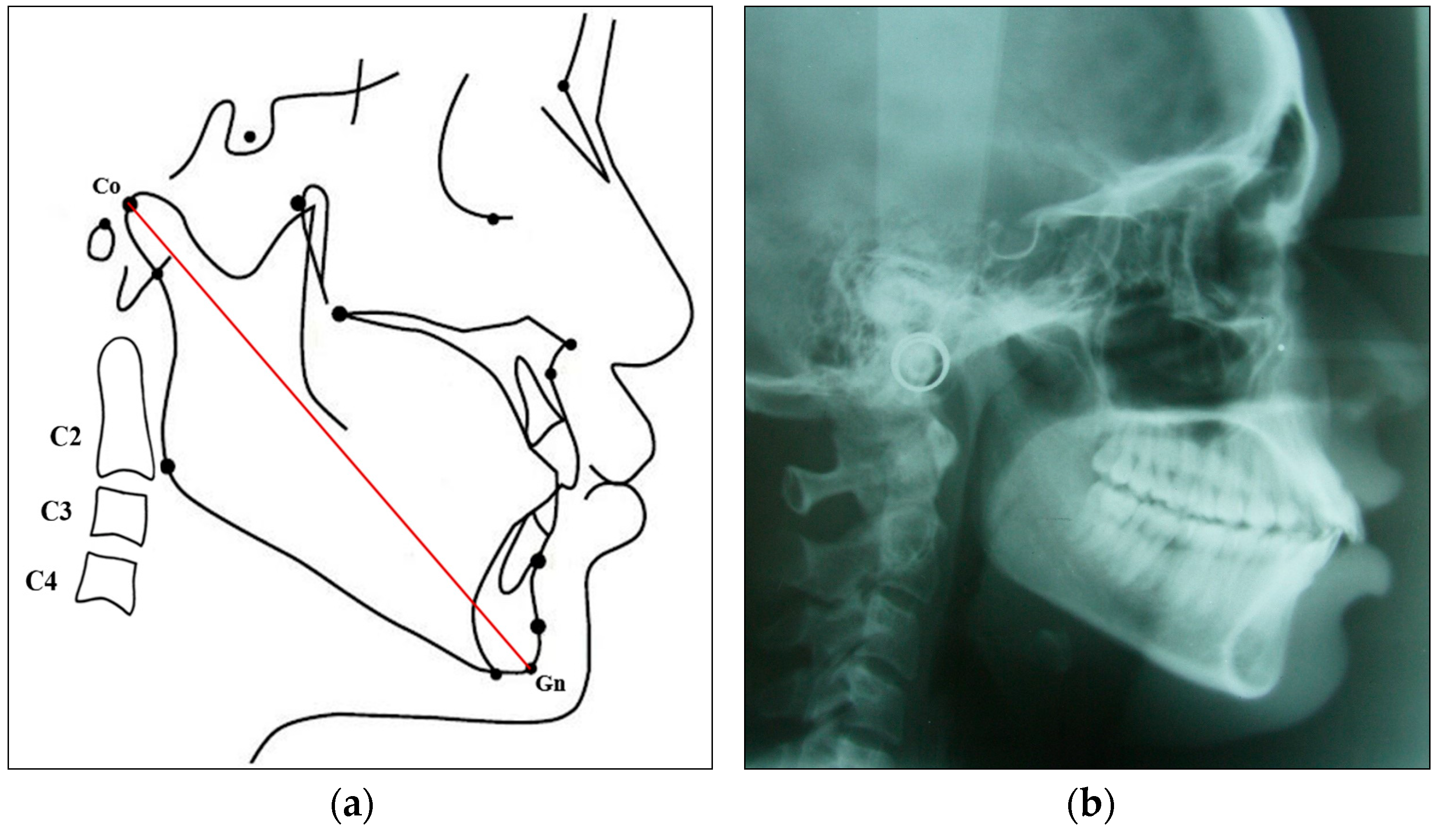 Diagnostics 14 02145 g002 Diagnostics 14 02145 g002