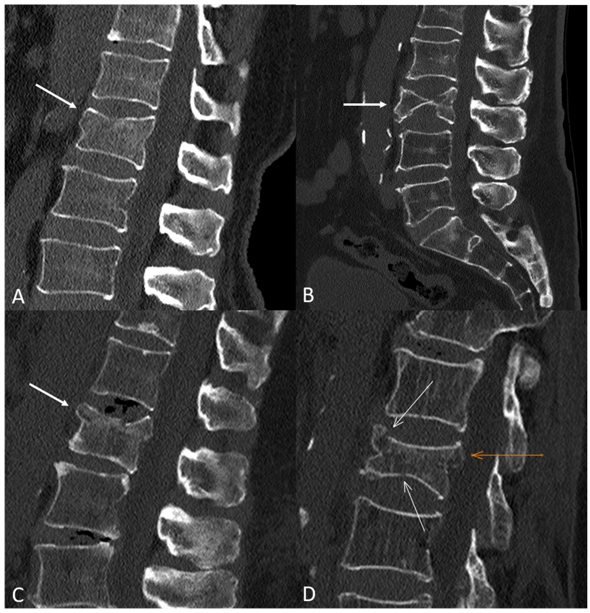 Diagnostics 14 02152 g001