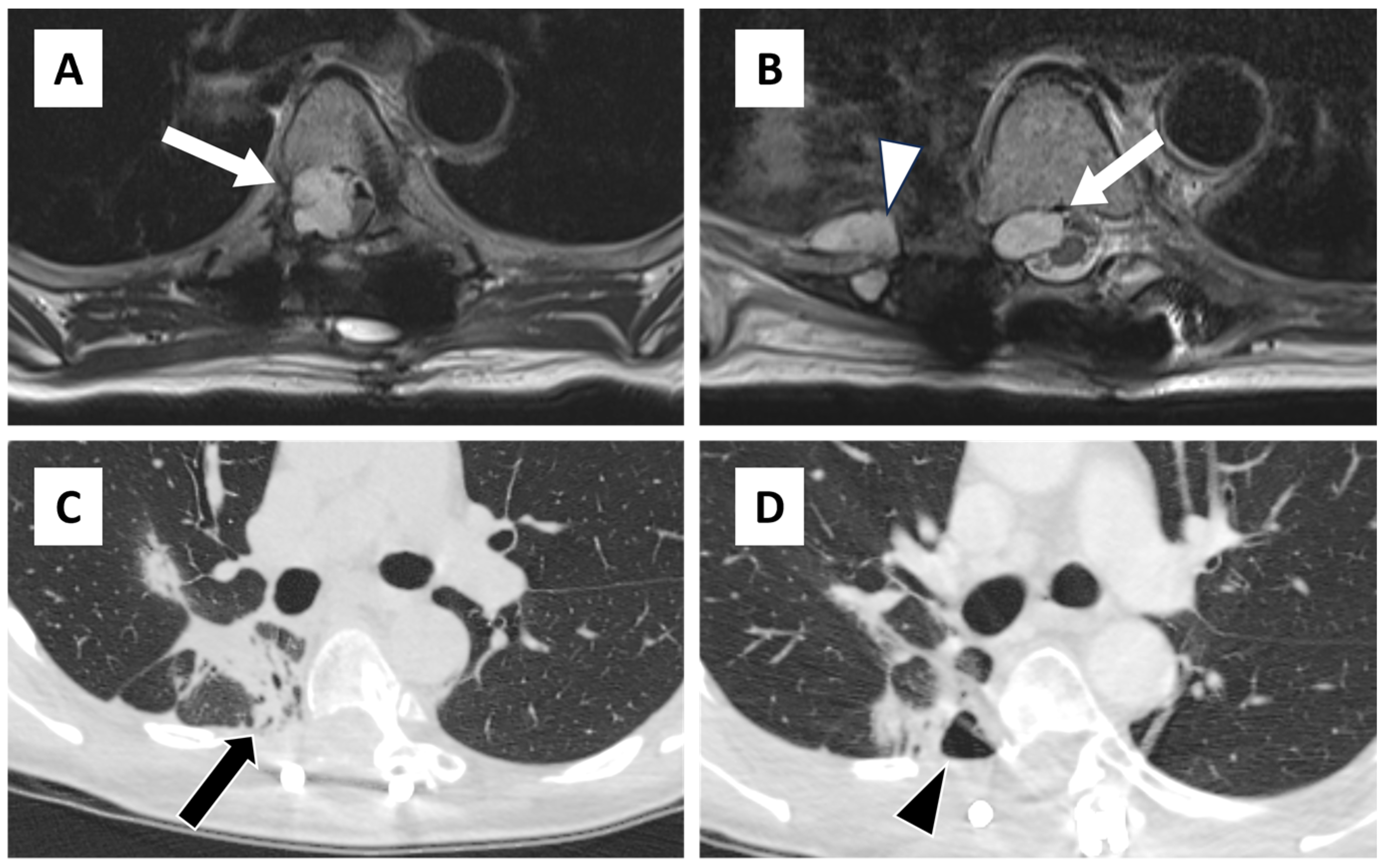 Diagnostics 14 02170 g001
