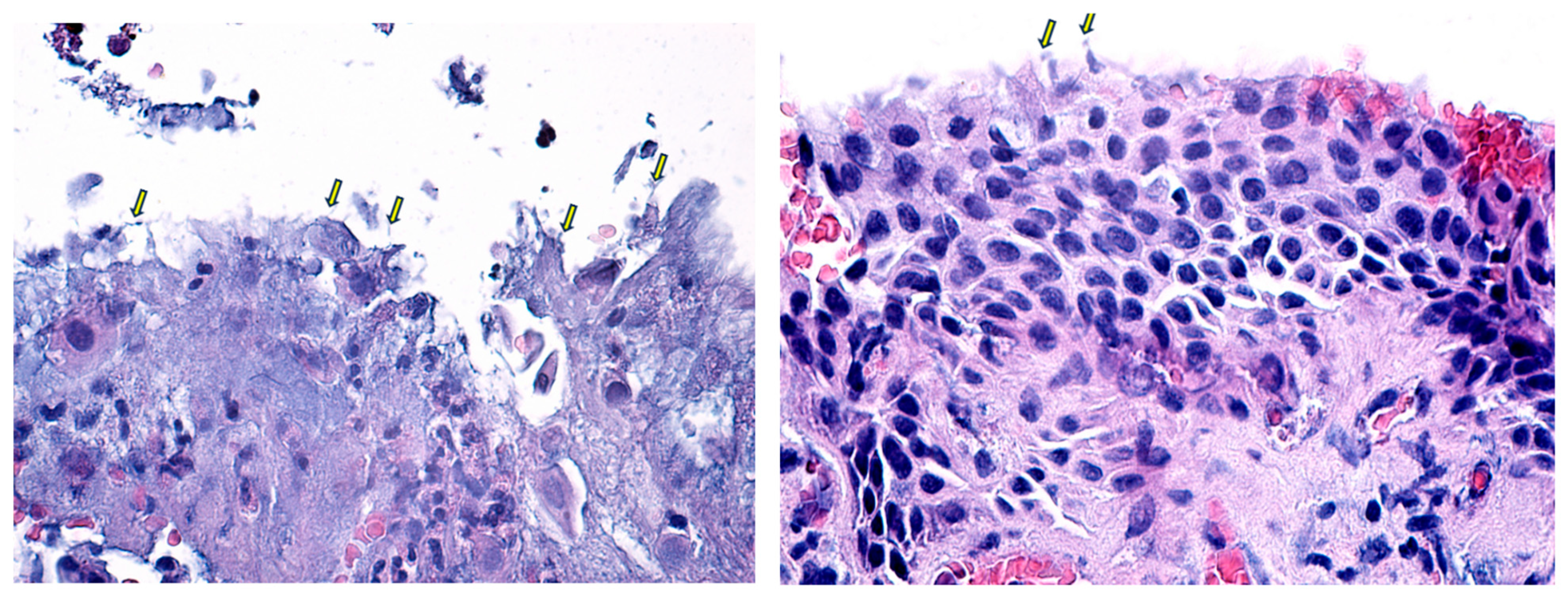 Diagnostics 14 02187 g006