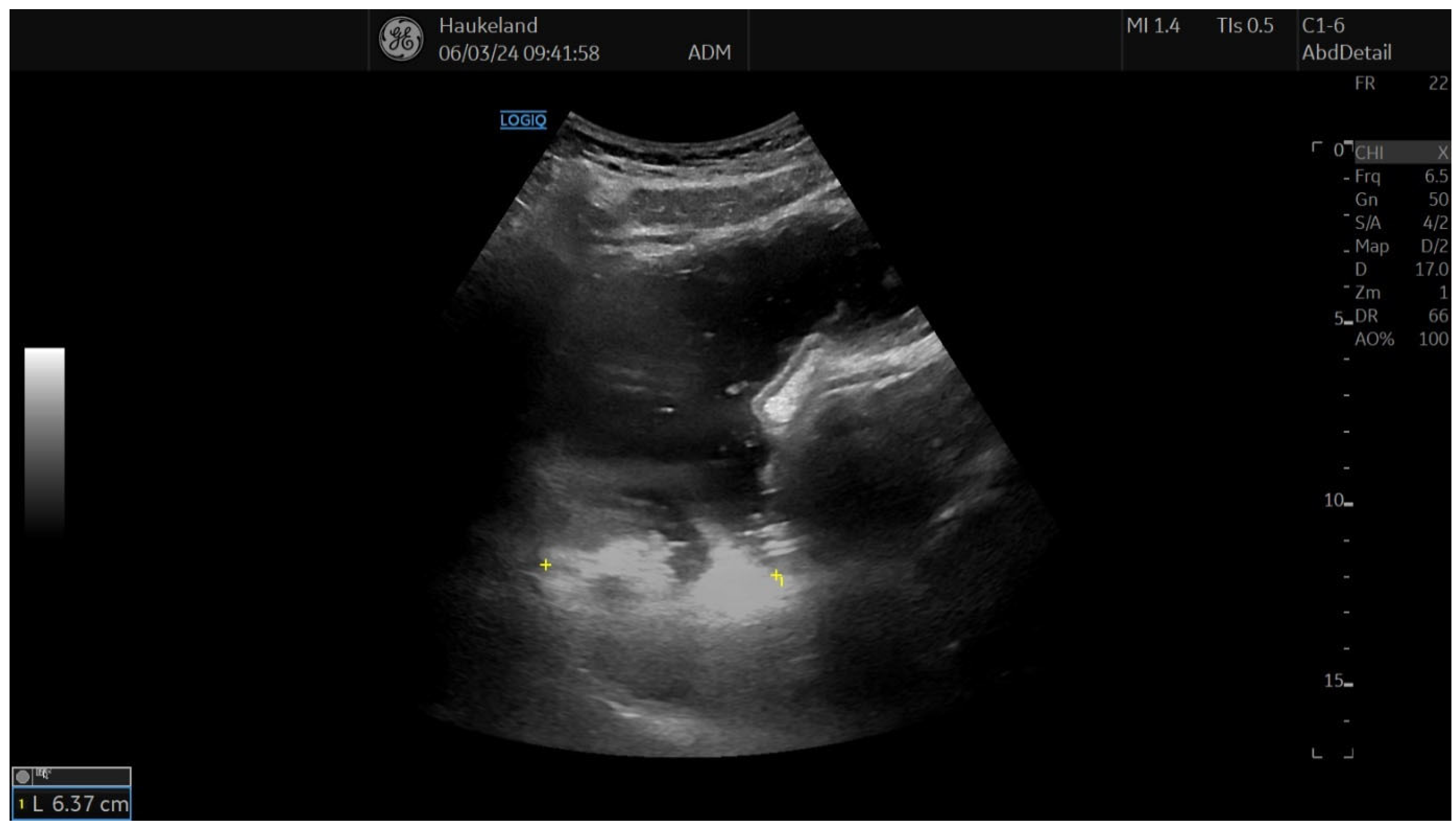 Diagnostics 14 02193 g004 Diagnostics 14 02193 g004