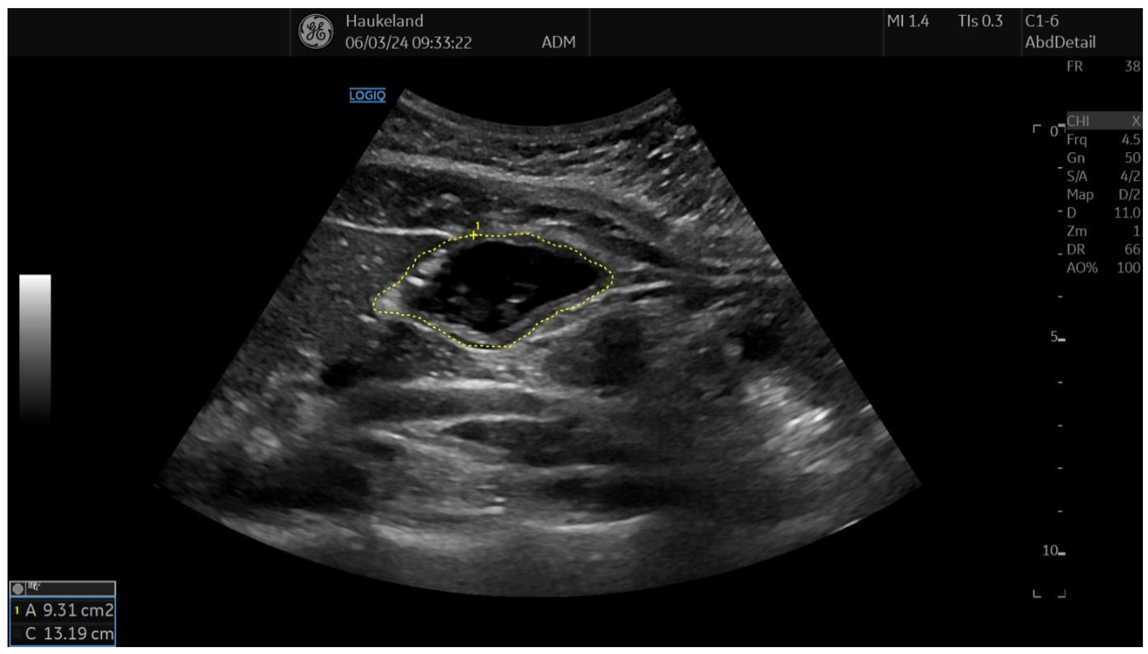 Diagnostics 14 02193 g005 Diagnostics 14 02193 g005