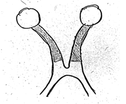 Diagnostics 14 02198 i003