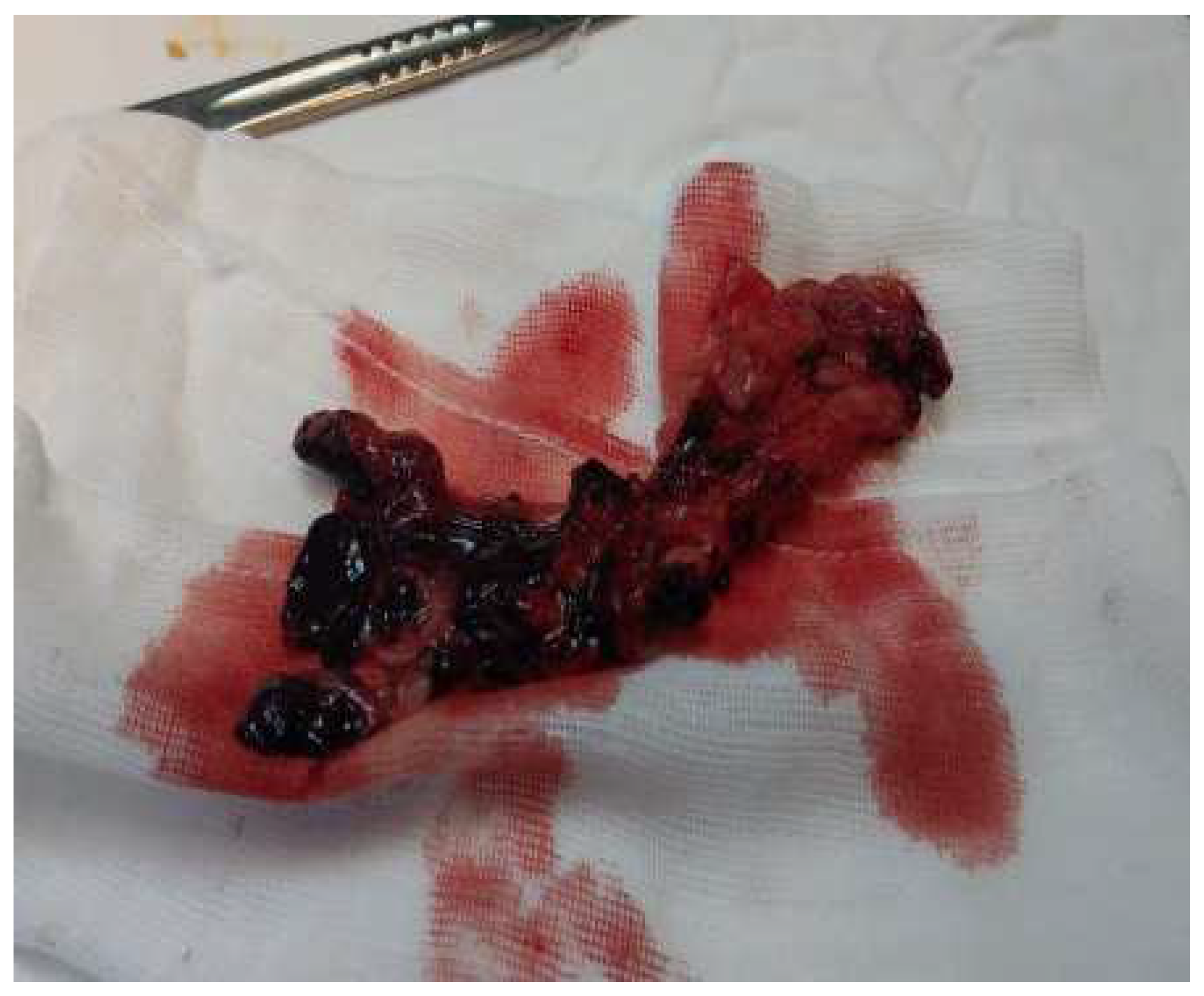 Diagnostics 14 02206 g003 Diagnostics 14 02206 g003