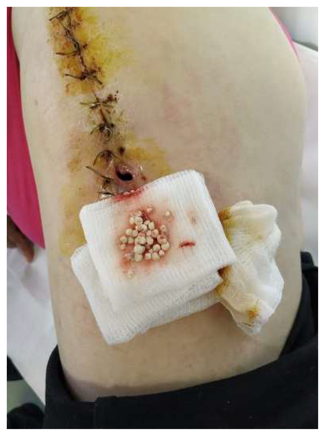 Diagnostics 14 02206 g006 Diagnostics 14 02206 g006