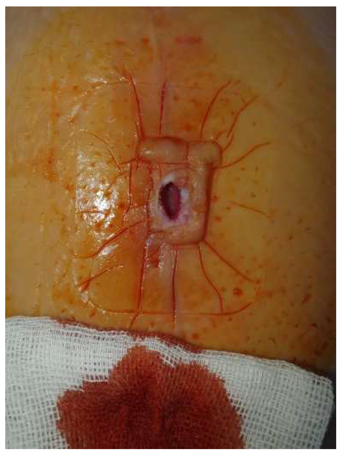 Diagnostics 14 02206 g008 Diagnostics 14 02206 g008