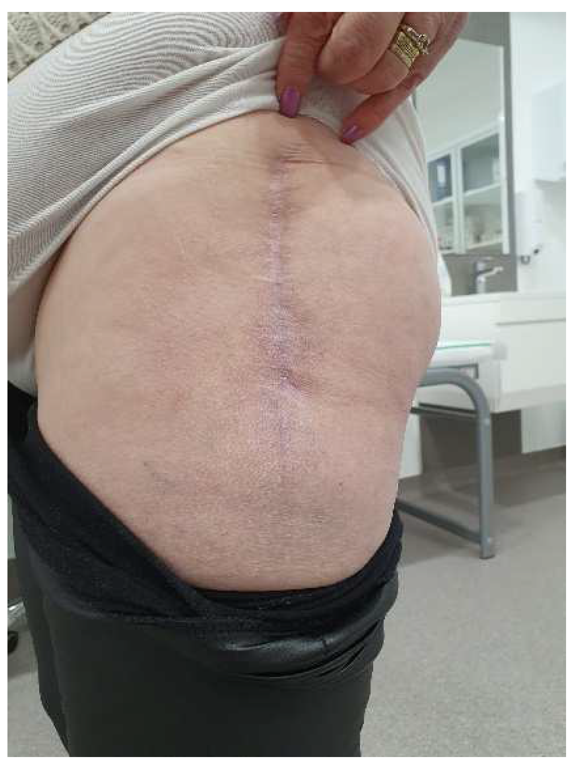 Diagnostics 14 02206 g010 Diagnostics 14 02206 g010