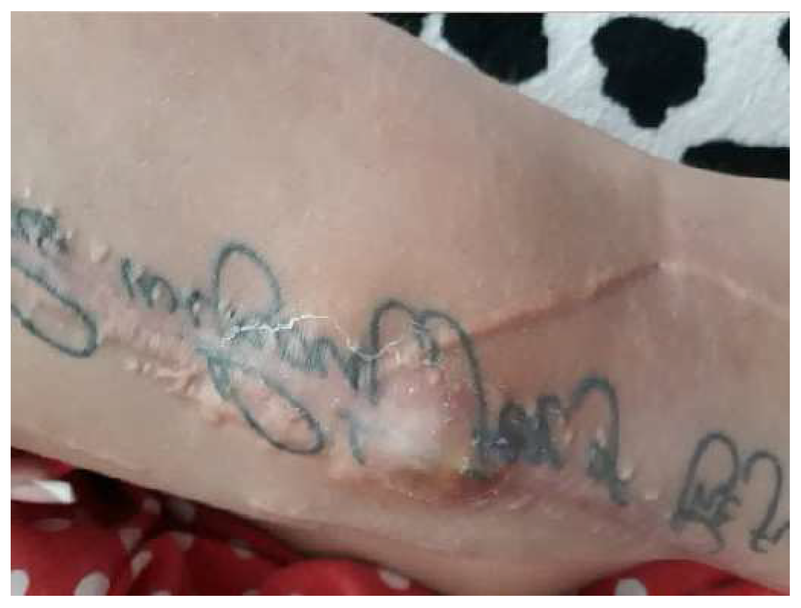 Diagnostics 14 02206 g011 Diagnostics 14 02206 g011