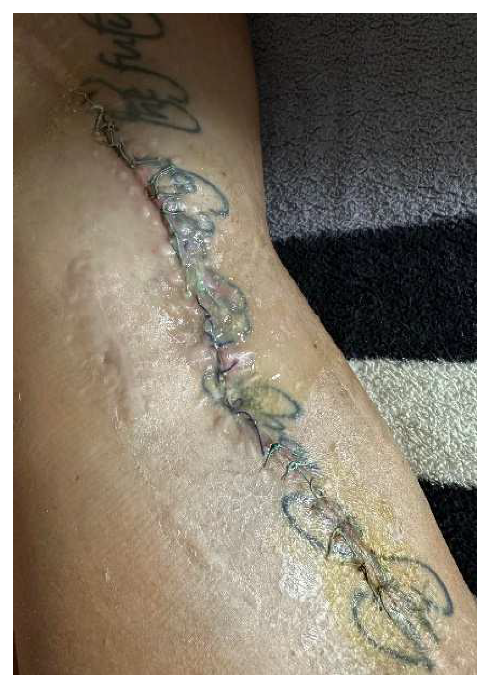 Diagnostics 14 02206 g017 Diagnostics 14 02206 g017