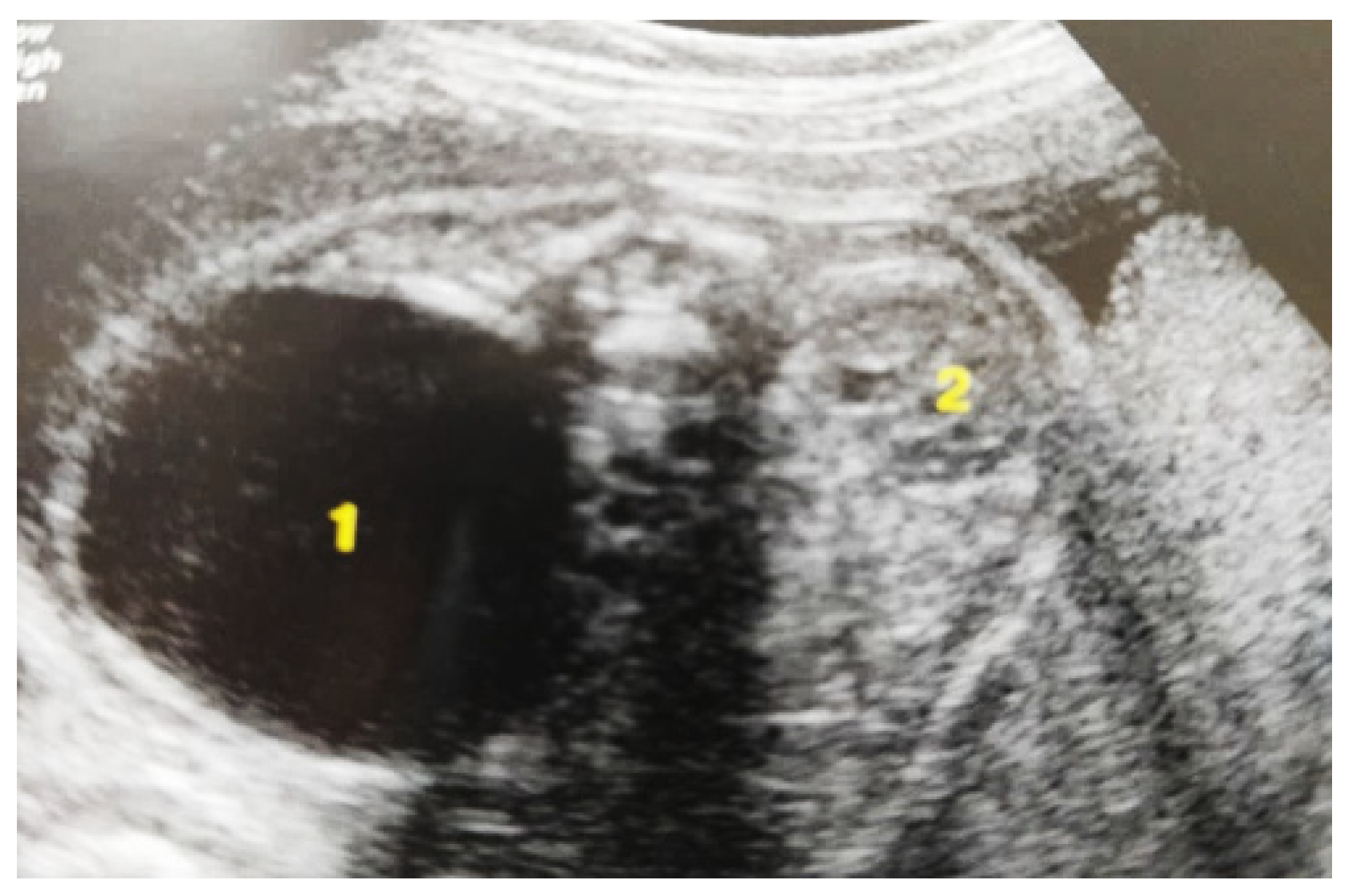 Diagnostics 14 02243 g003