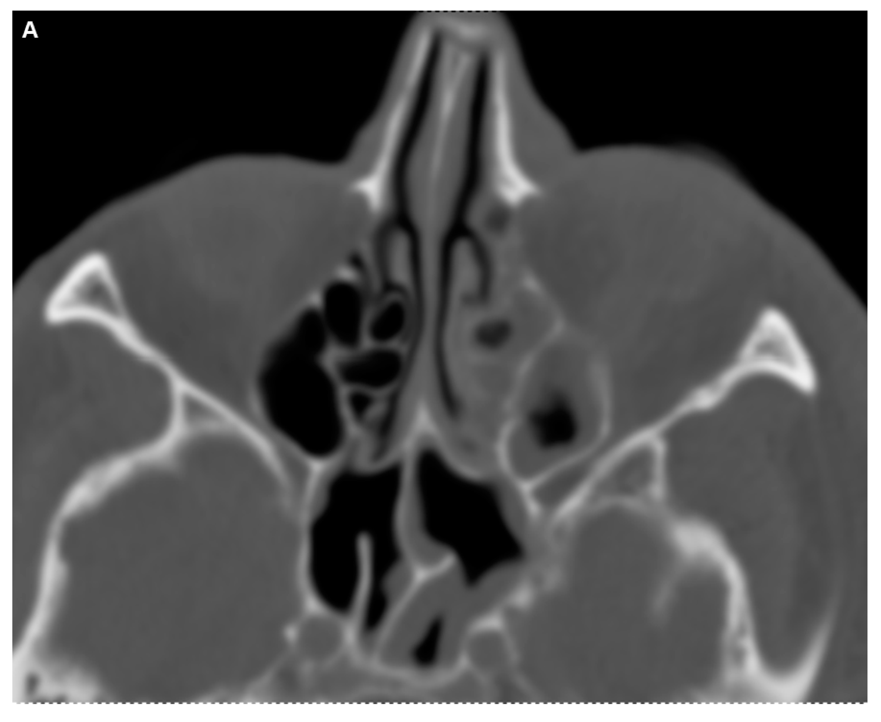 Diagnostics 14 02246 g003a