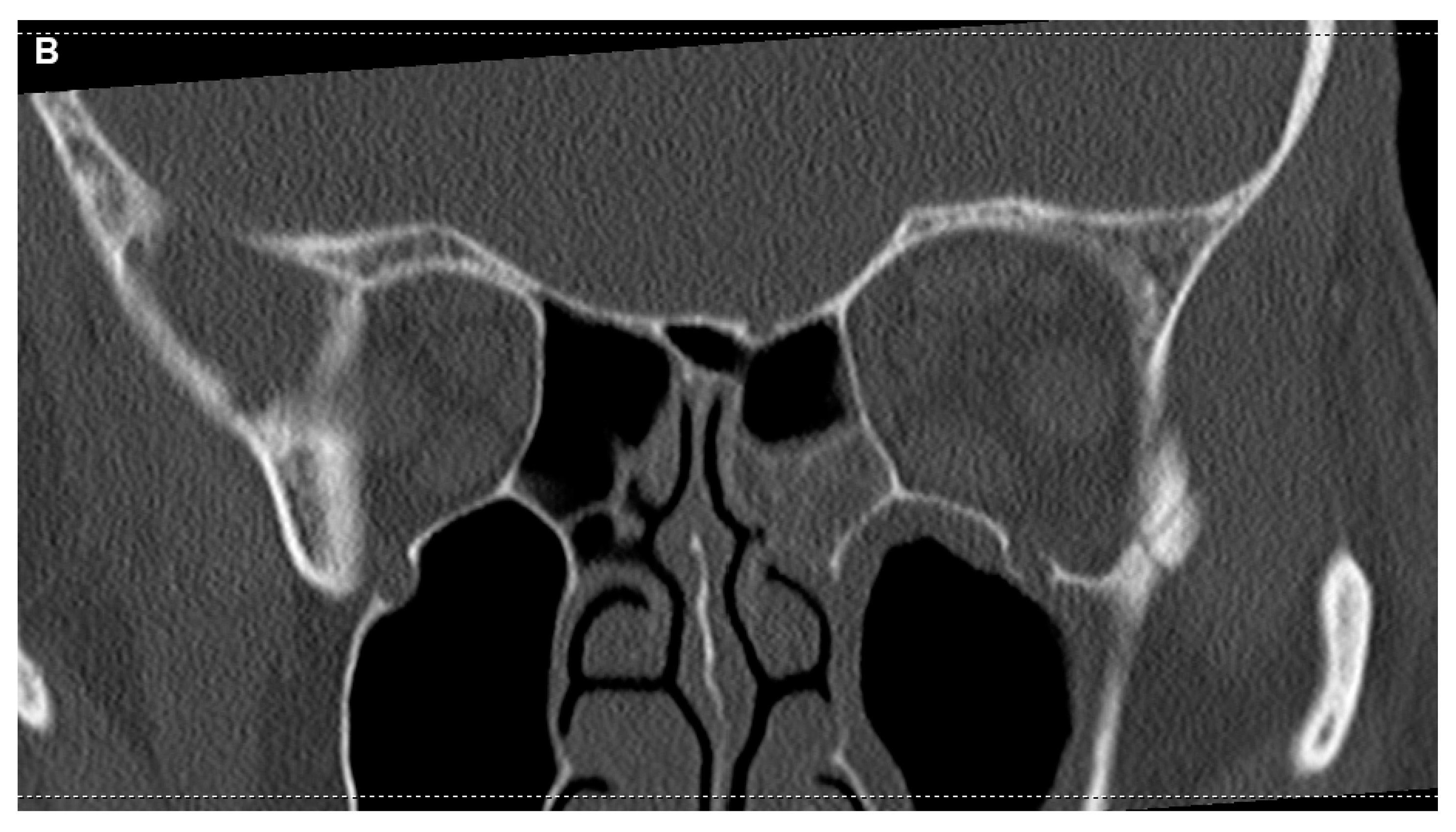 Diagnostics 14 02246 g003b