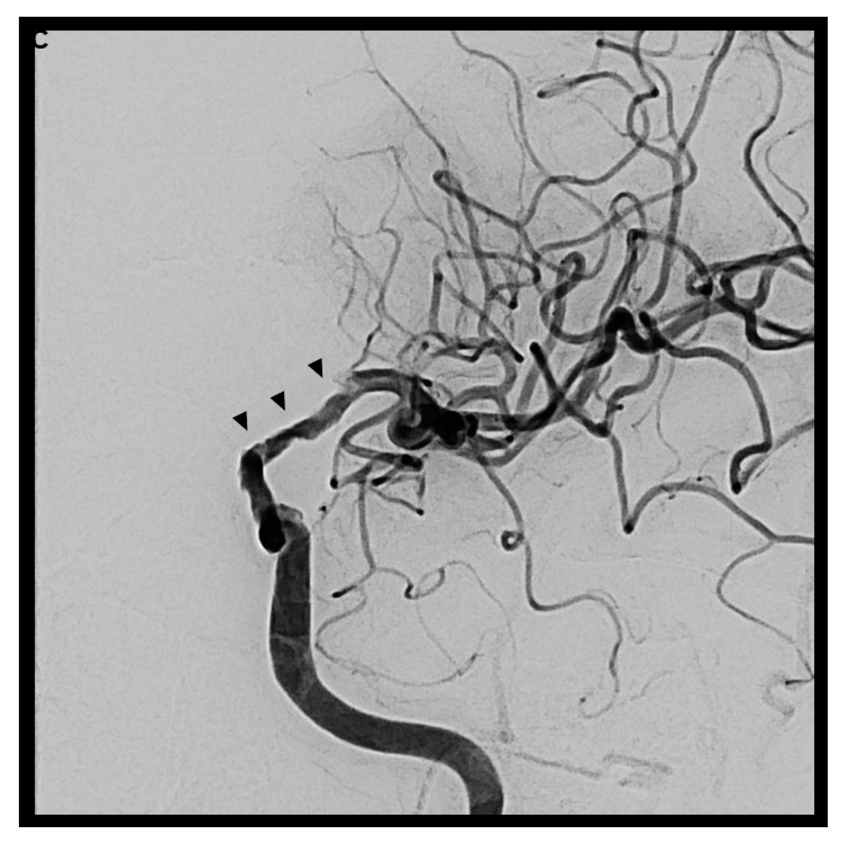 Diagnostics 14 02246 g005b