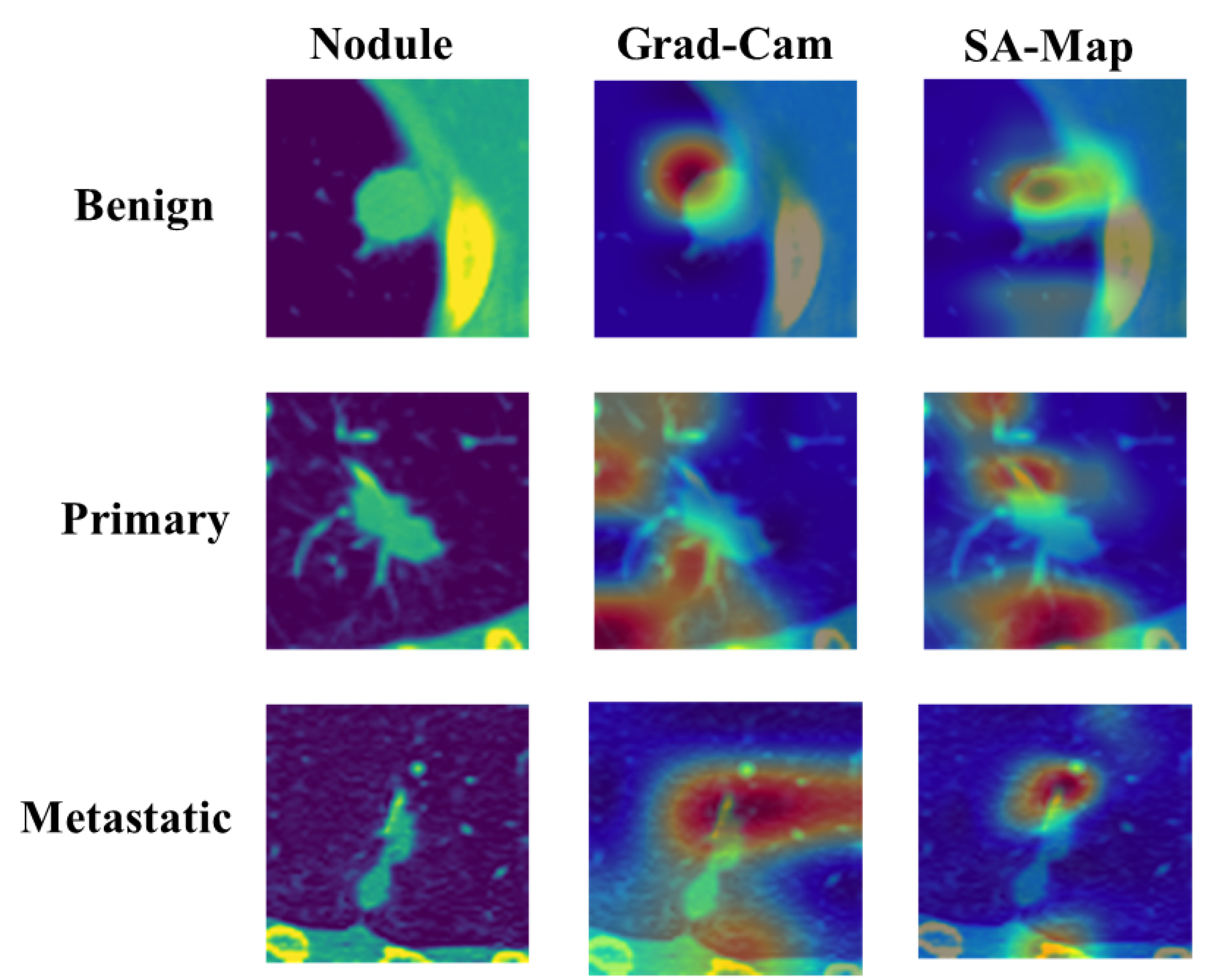 Diagnostics 14 02282 g011
