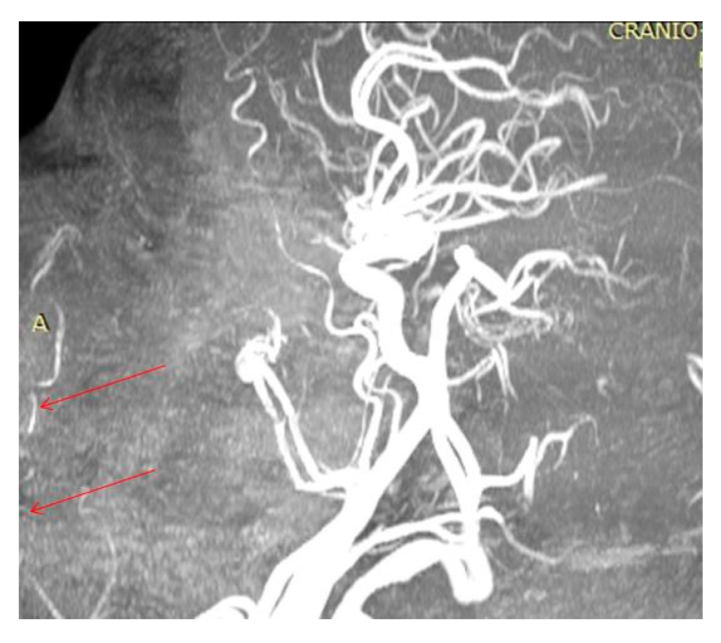Diagnostics 14 02294 g004
